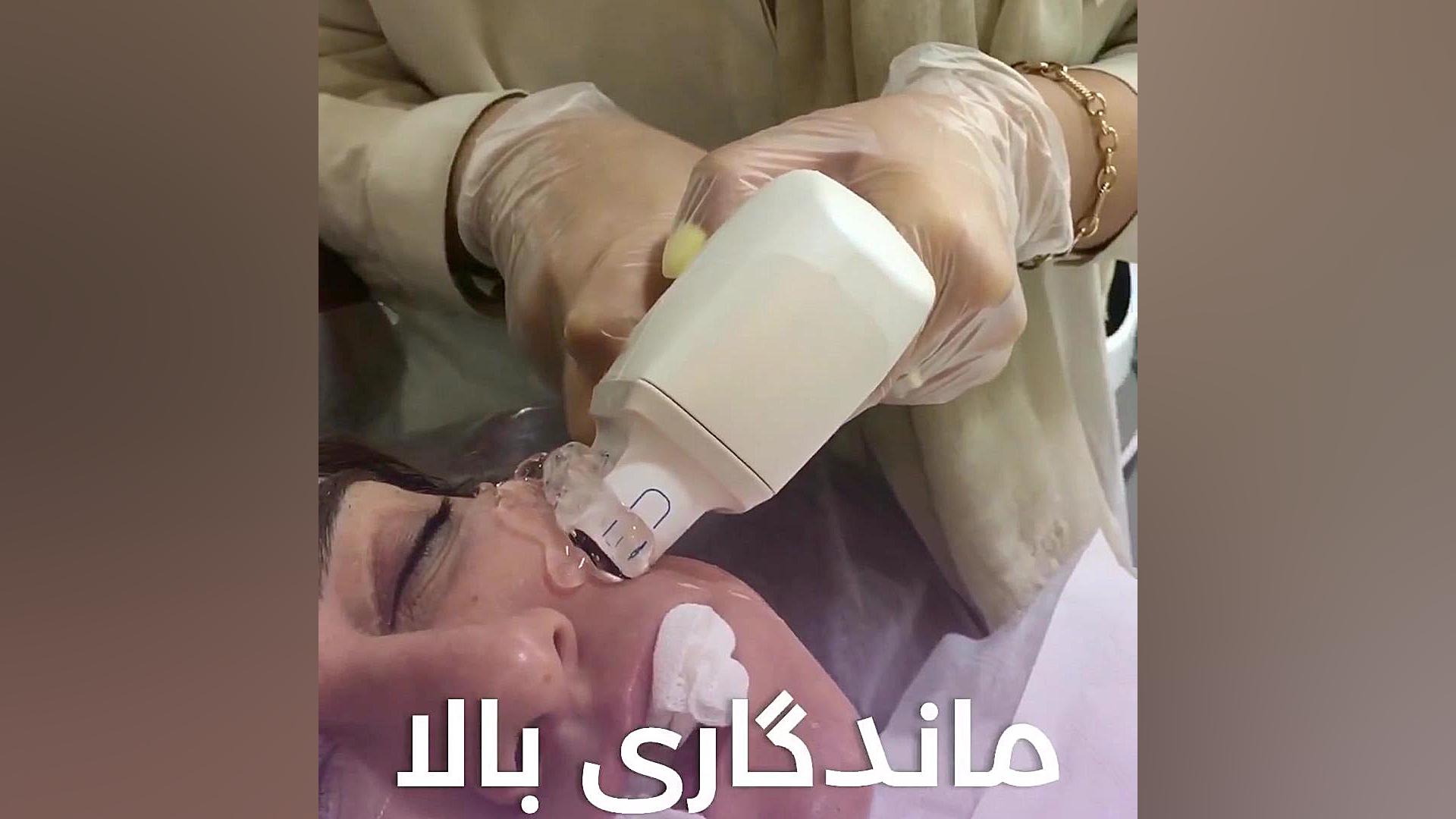 مزایای هایفوتراپی دندان مصنوعی