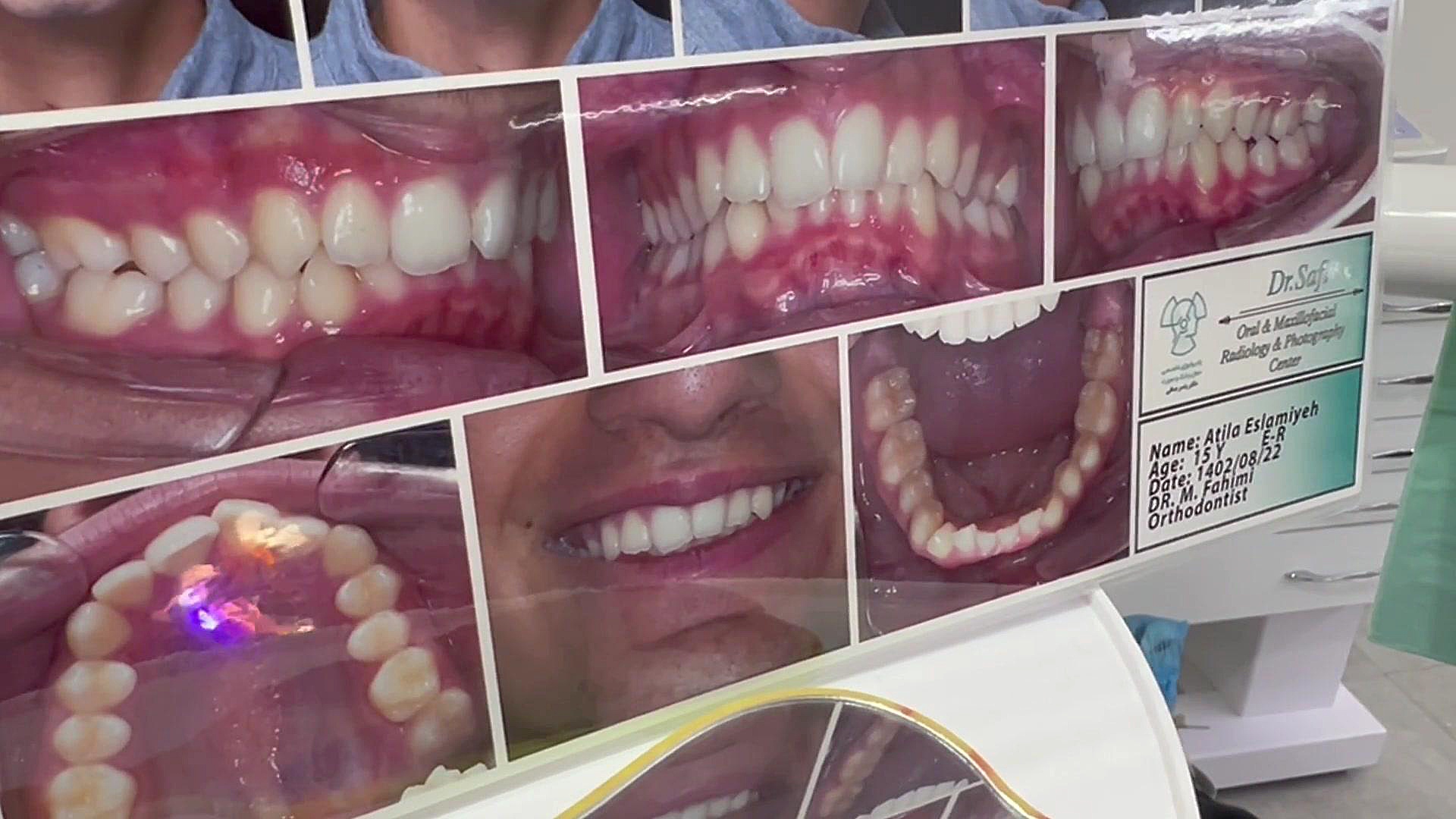 ارتودنسی ستارخان دكتر مهدي فهيمي هنزائي