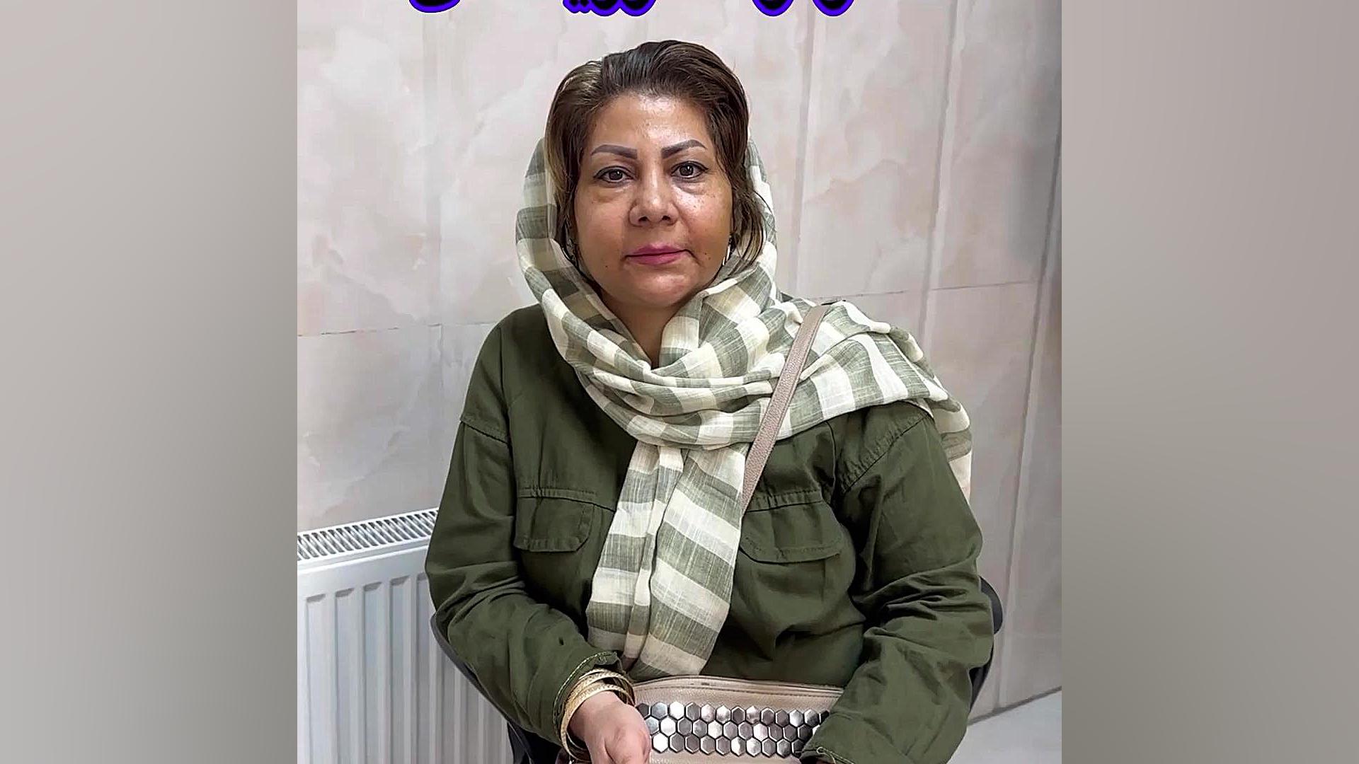 هفت روز بعد از تزریق چربی برای جوانسازی و رفع افتادگی صورت دکتر فرحناز زینعلی - متخصص پوست، مو، زیبایی زنجان