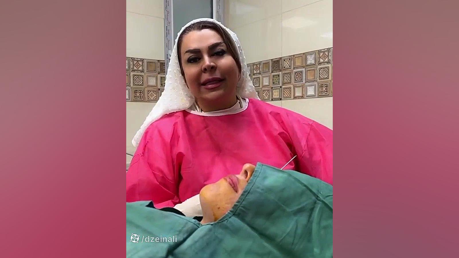 تزریق چربی به صورت خانم جوان به متد مادلینگ دکتر فرحناز زینعلی - متخصص پوست، مو، زیبایی زنجان