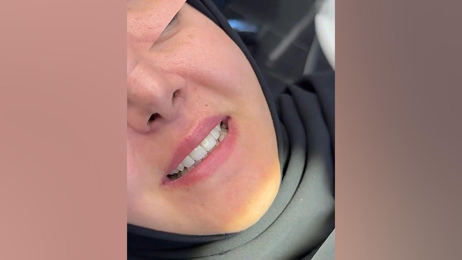 روکش سرامیکی دکتر طاهره شاکری کلینیک دندانپزشکی آرت دنتال دکتر شاکری