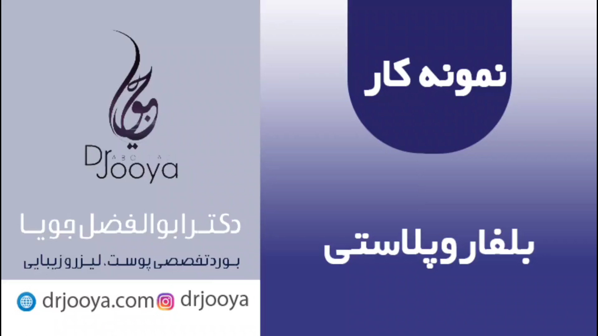 نمونه کار بلفاروپلاستی | بهترین متخصص پوست و زیبایی اصفهان دکتر ابوالفضل جویا