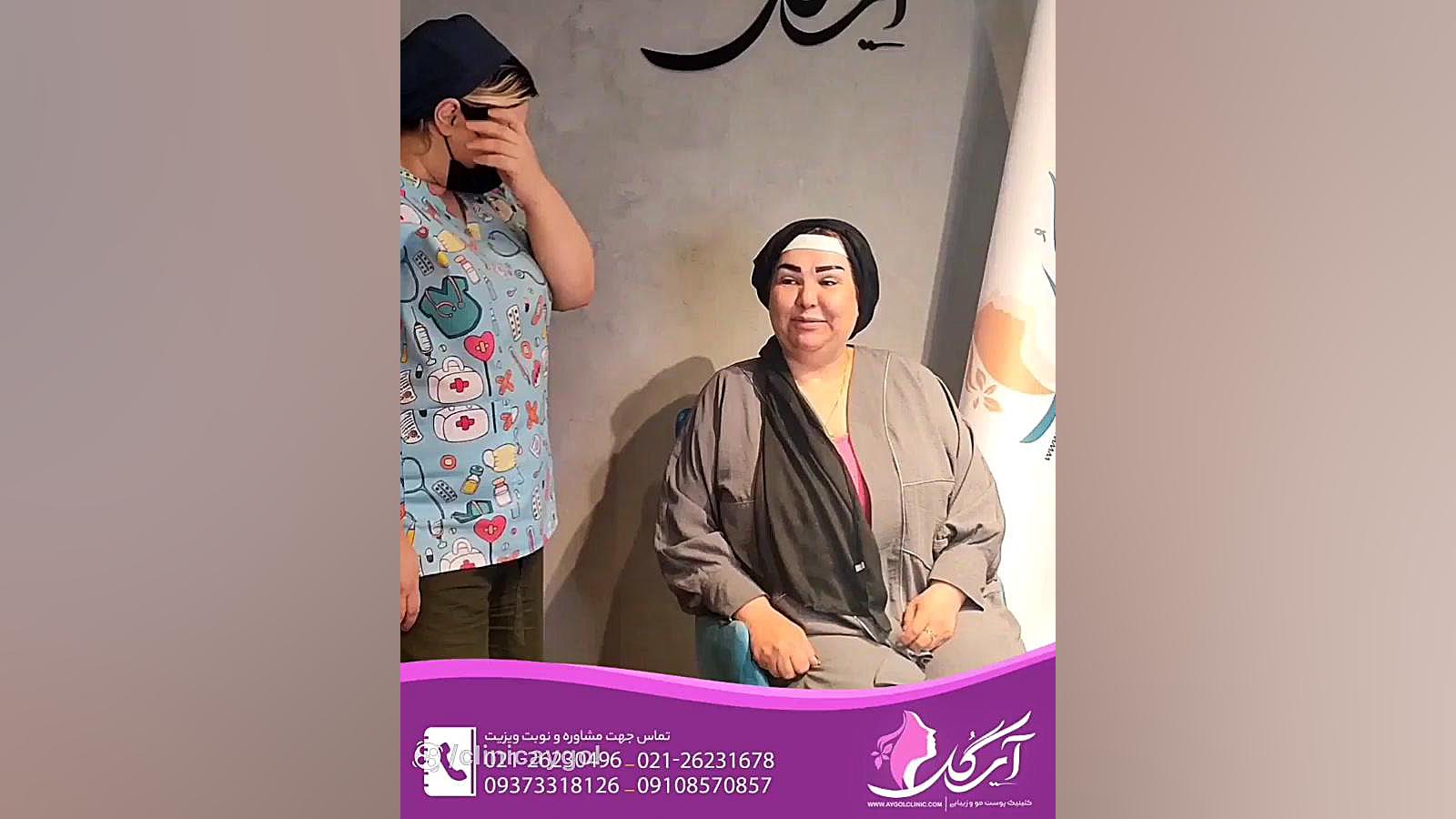 بهترین نتایج عمل بلفاروپلاستی در کلینیک آی گل گلوسودینیا