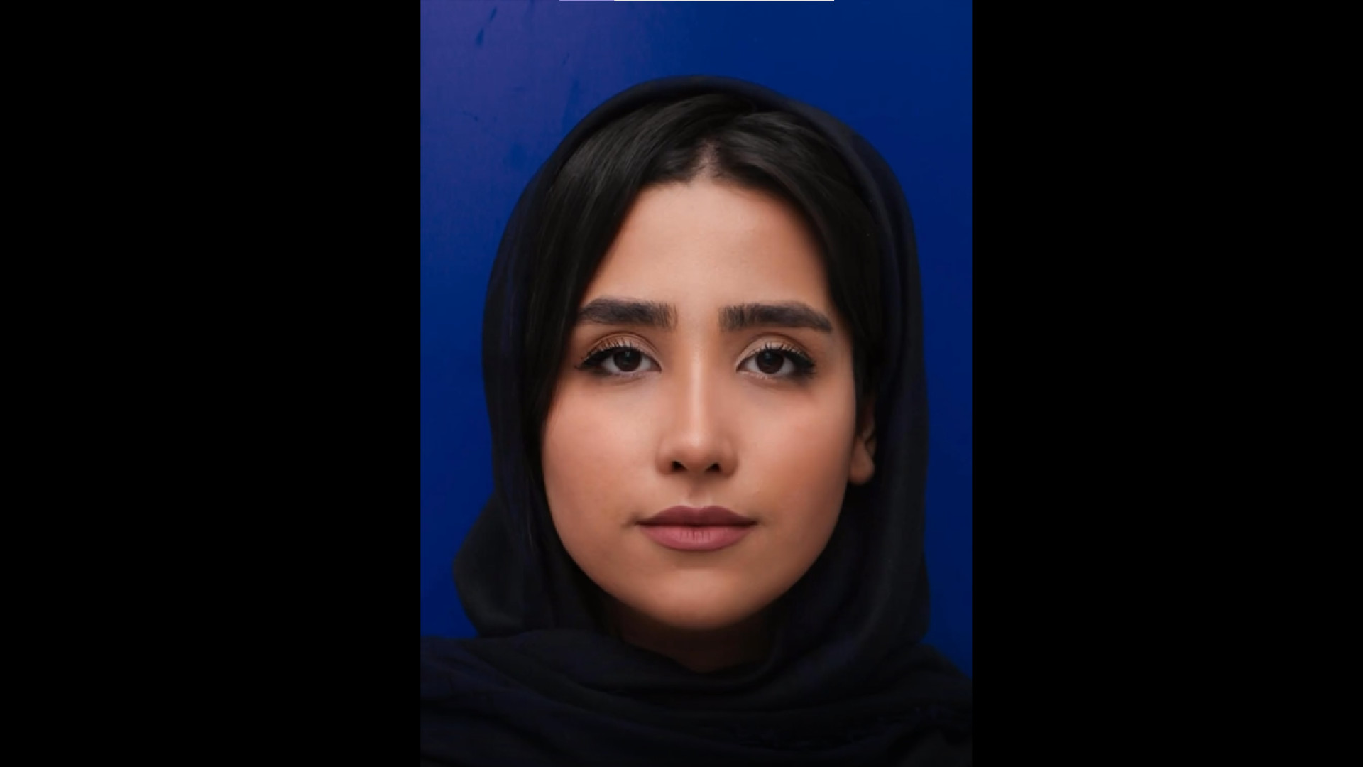 نتیجه فوق العاده جراحی بینی استخوانی به سبک طبیعی شیک - 4 ماه بعد از عمل دکتر محمد مجیدی - جراحی بینی به سبک طبیعی شیک