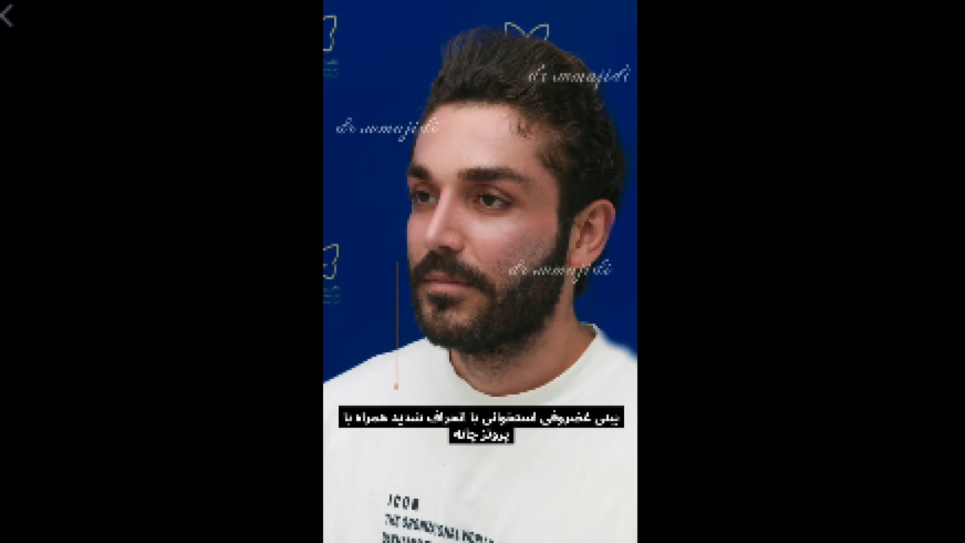 جراحی بینی استخوانی همراه با عمل پروتز چانه دکتر محمد مجیدی - جراحی بینی به سبک طبیعی شیک