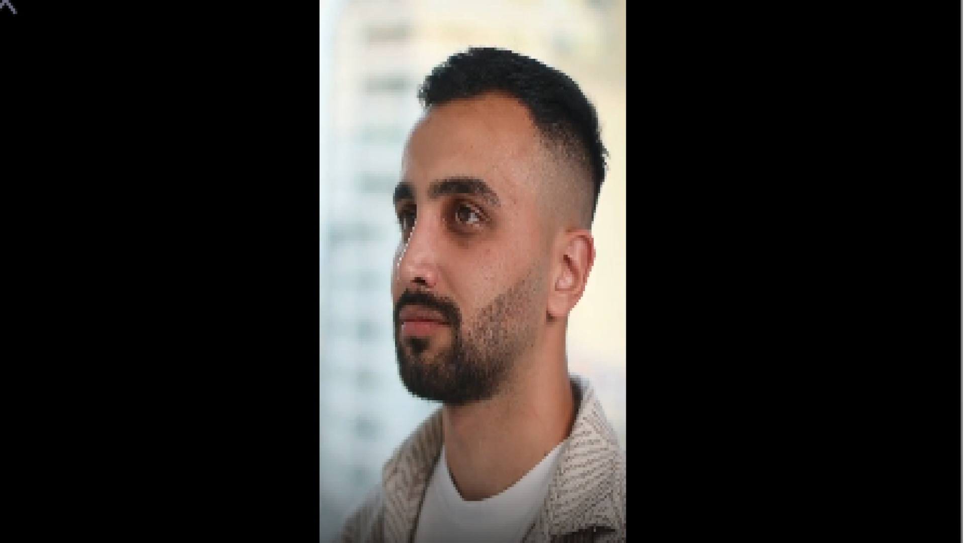عمل بینی طبیعی و مردانه دکتر محمد مجیدی - جراحی بینی به سبک طبیعی شیک