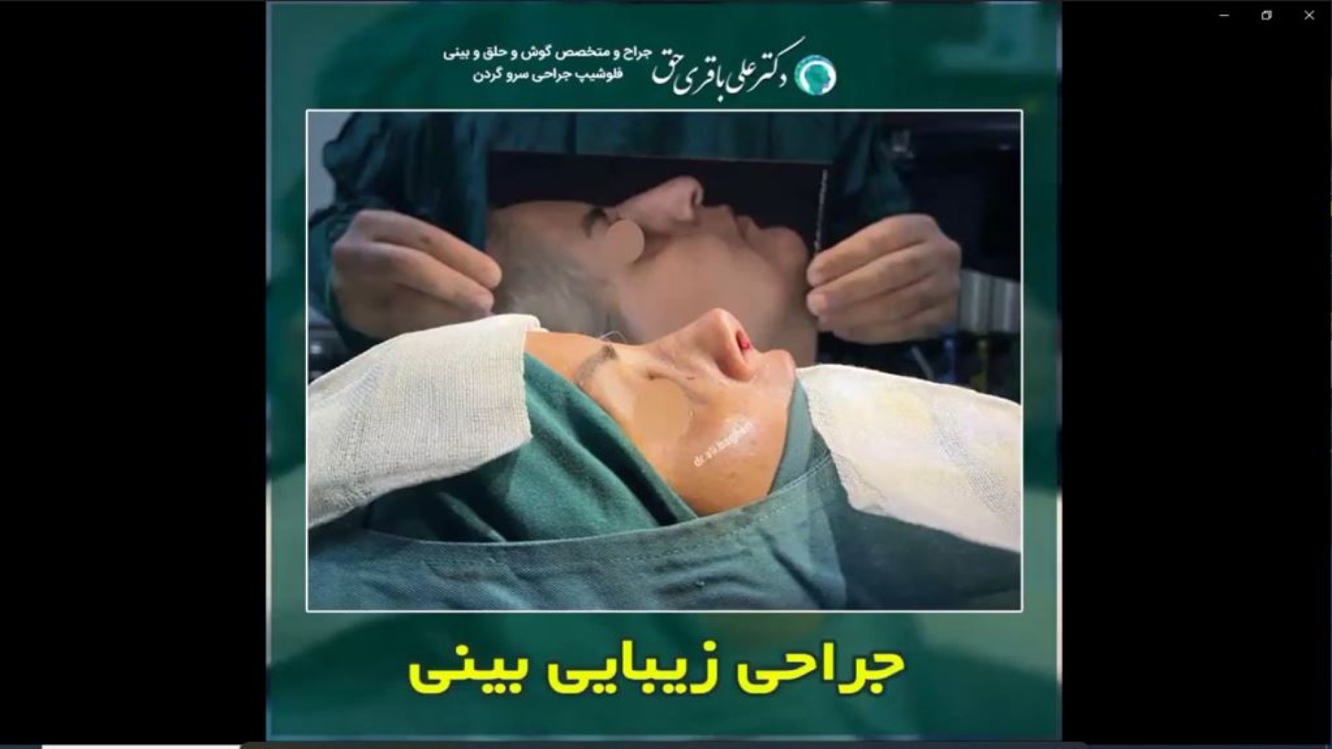 جراحی زیبایی بینی | دکتر باقری حق دکتر علی باقری حق