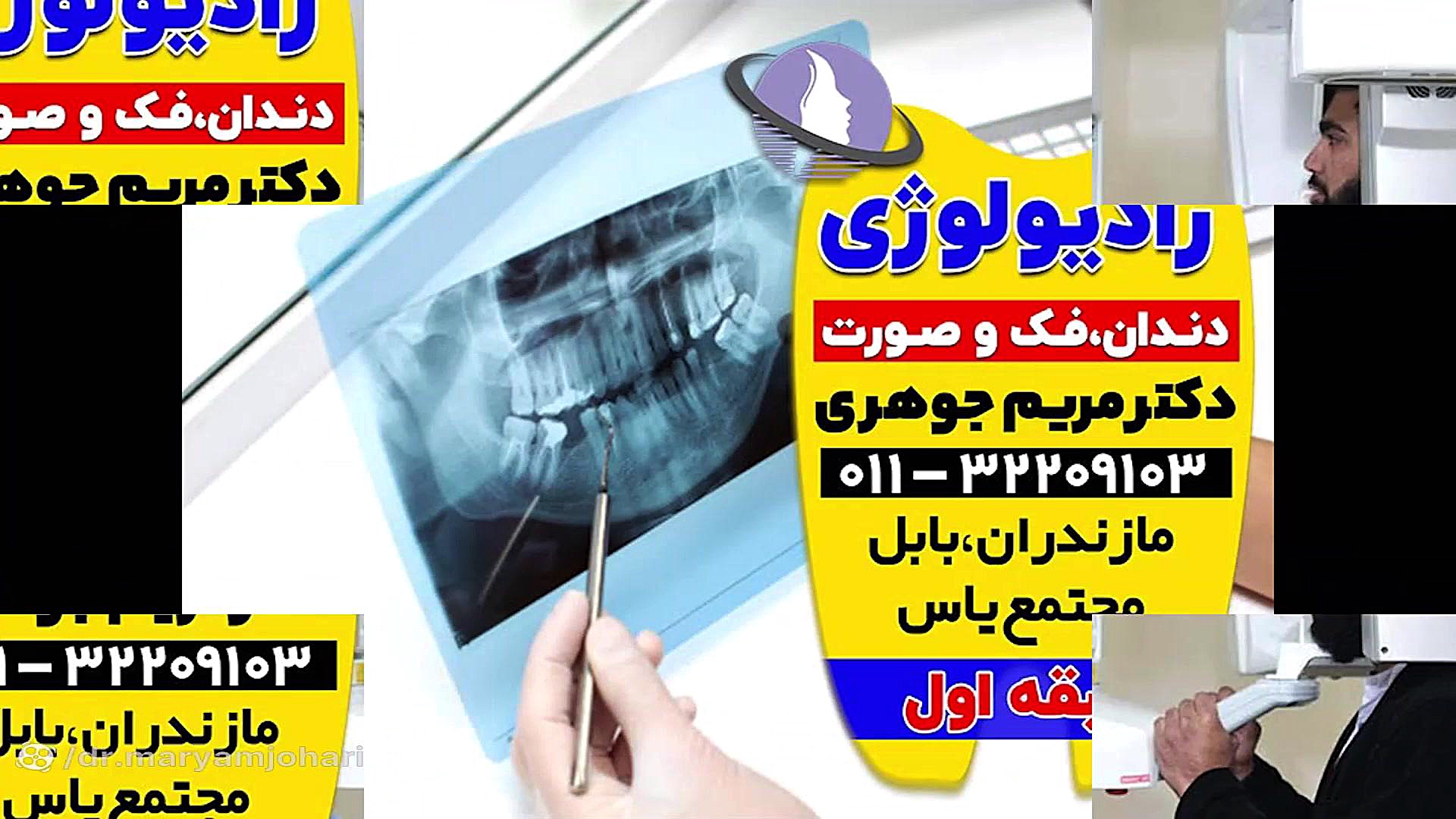 بهترین مرکز تصویربرداری دندان و دهان آمل و قائمشهر | دکتر مریم جوهری دکتر مریم جوهری