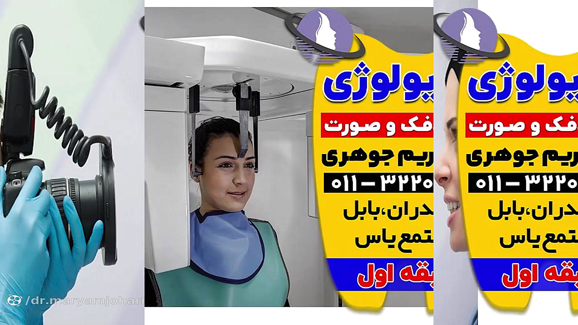 بهترین فتوگرافی چهره فریدونکنار و سرخرود | دکتر مریم جوهری دکتر مریم جوهری