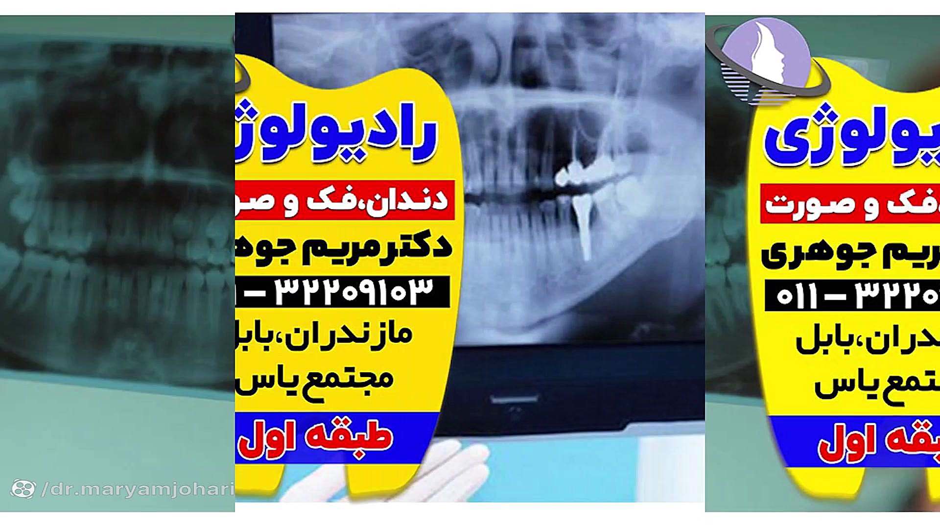 بهترین متخصص رادیولوژی آمل و قائمشهر | دکتر مریم جوهری دکتر مریم جوهری