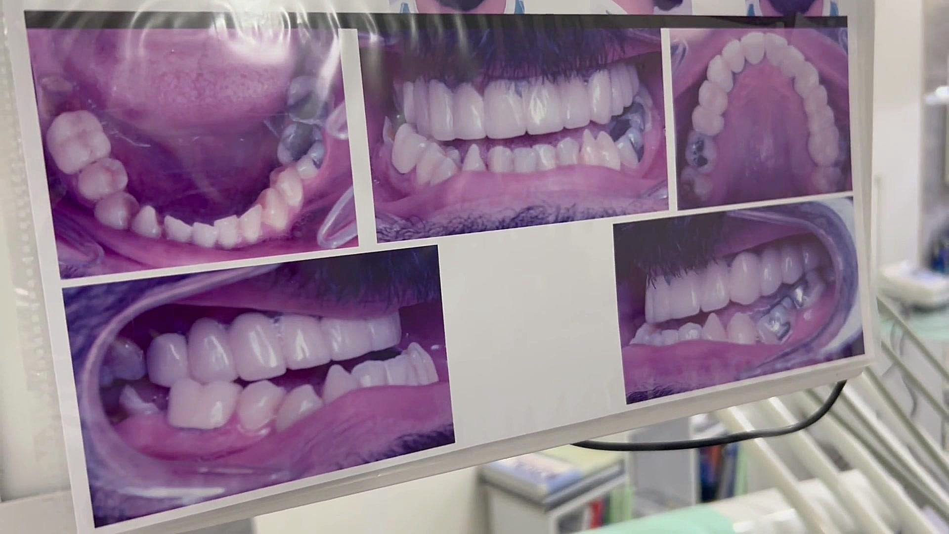 ارتودنسی برای جراحی دكتر مهدي فهيمي هنزائي