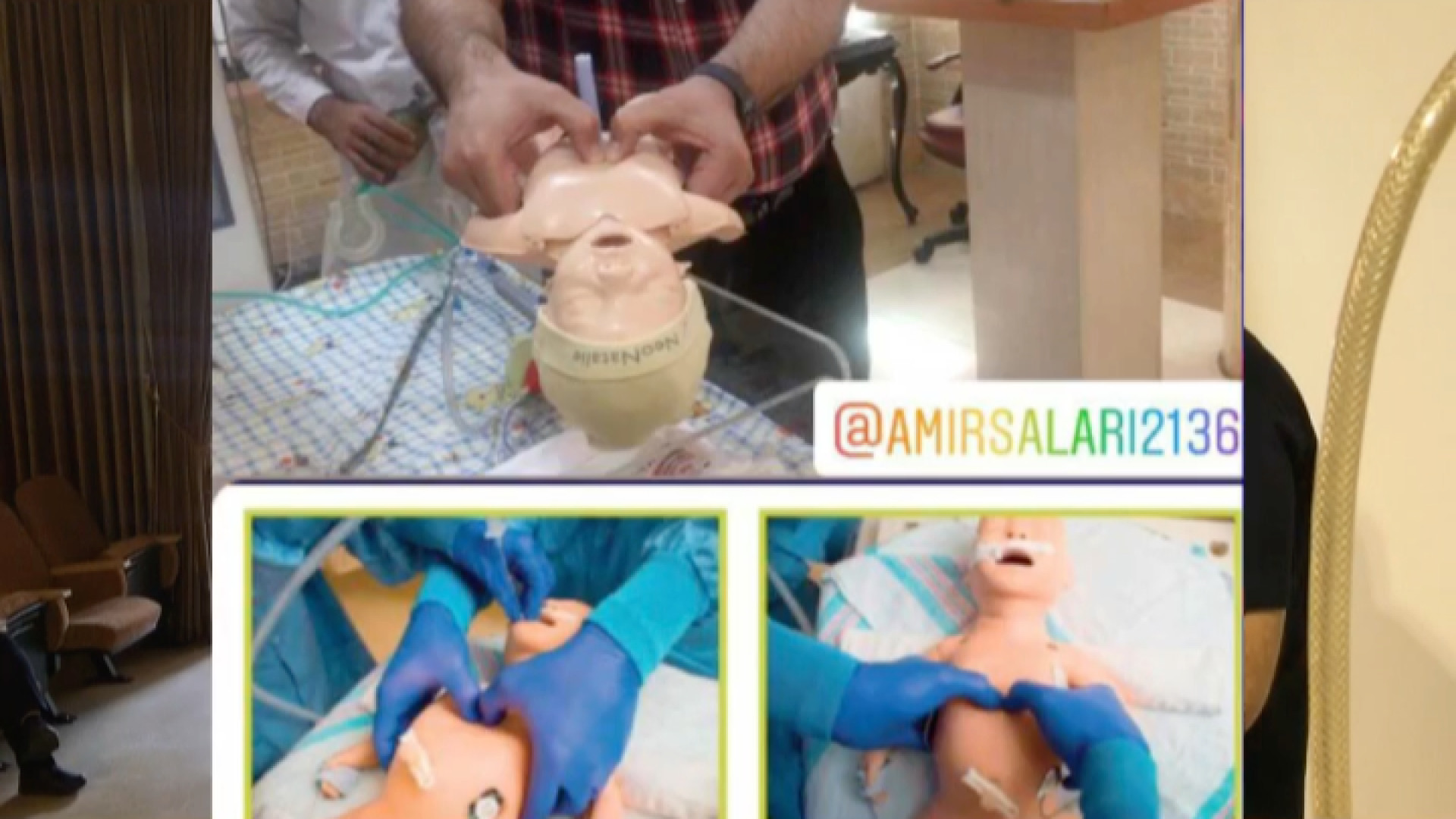 نحوه انجام فشردن قفسه سينه در حين احياي نوزادان رفع افتادگی پلک