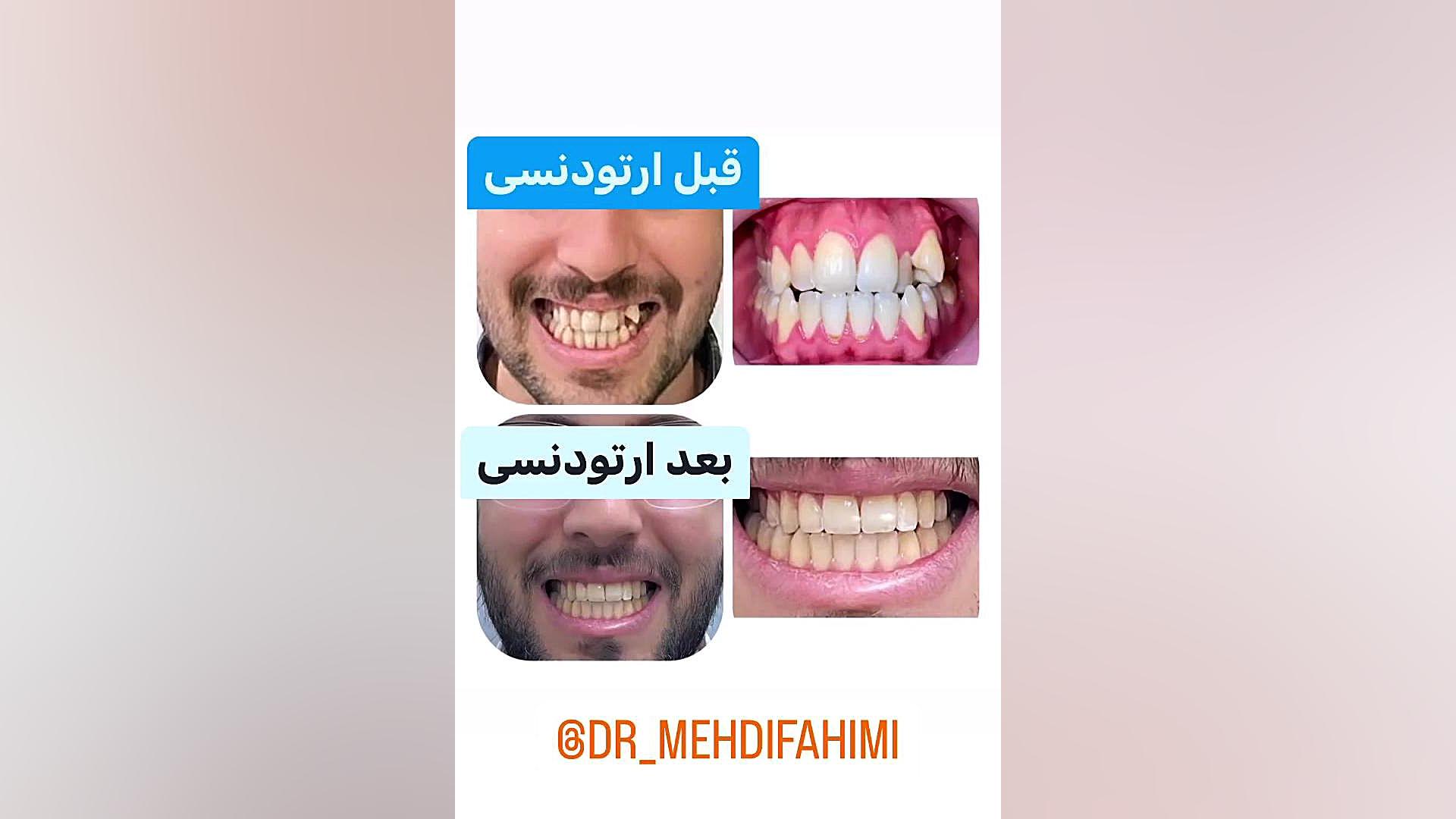 ارتودنسی تهران دكتر مهدي فهيمي هنزائي