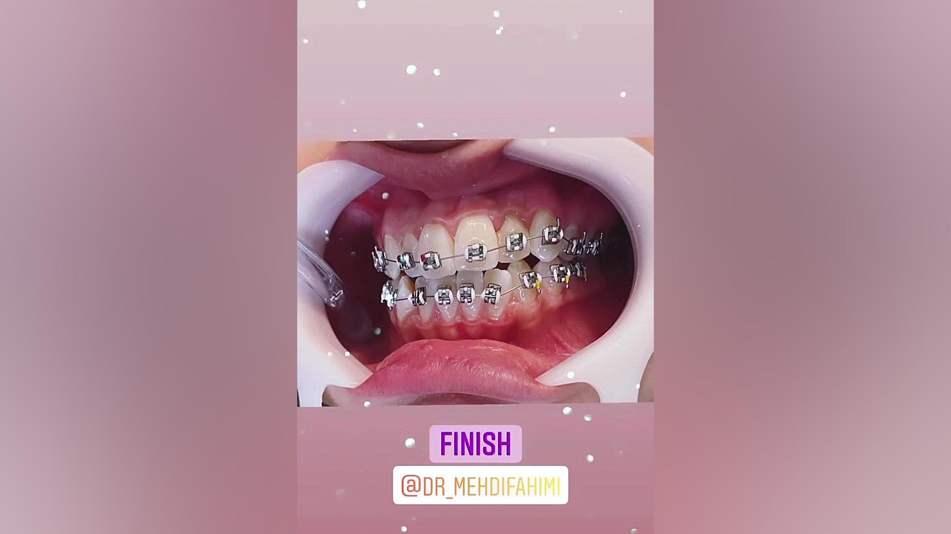 ارتودنسی دکتر فهیمی دكتر مهدي فهيمي هنزائي