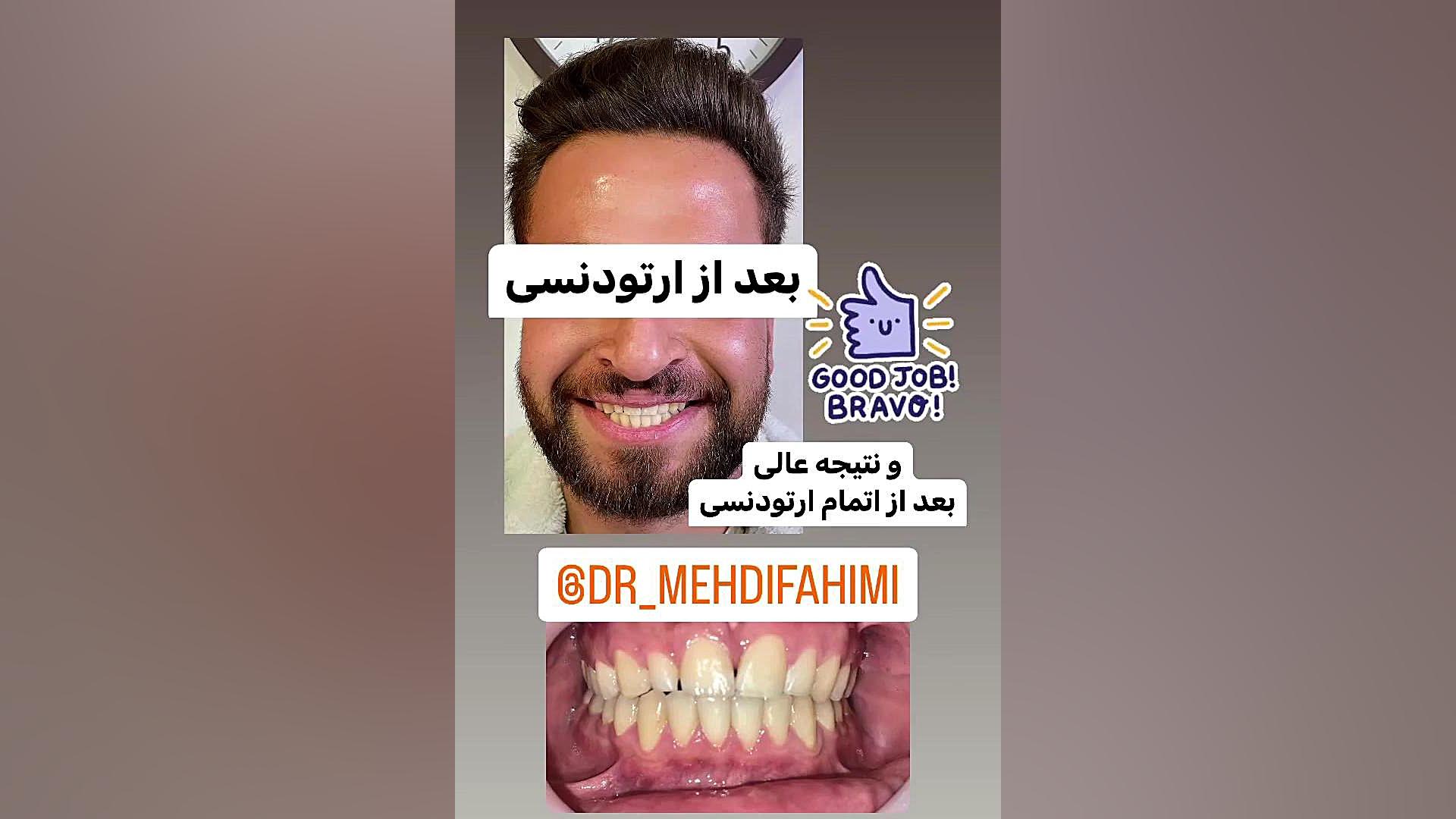 فاصله بین دندانی دكتر مهدي فهيمي هنزائي