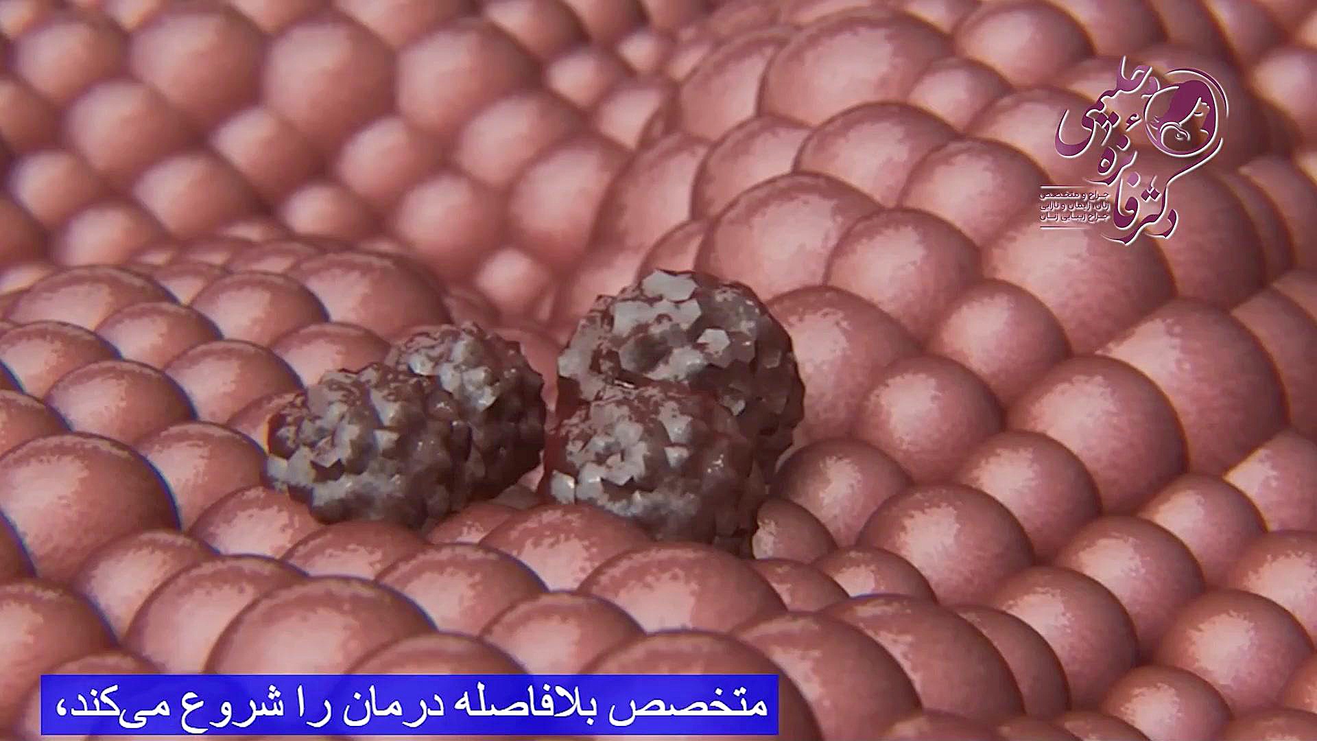 تست پاپ اسمیر دکتر فائزه حلیمی