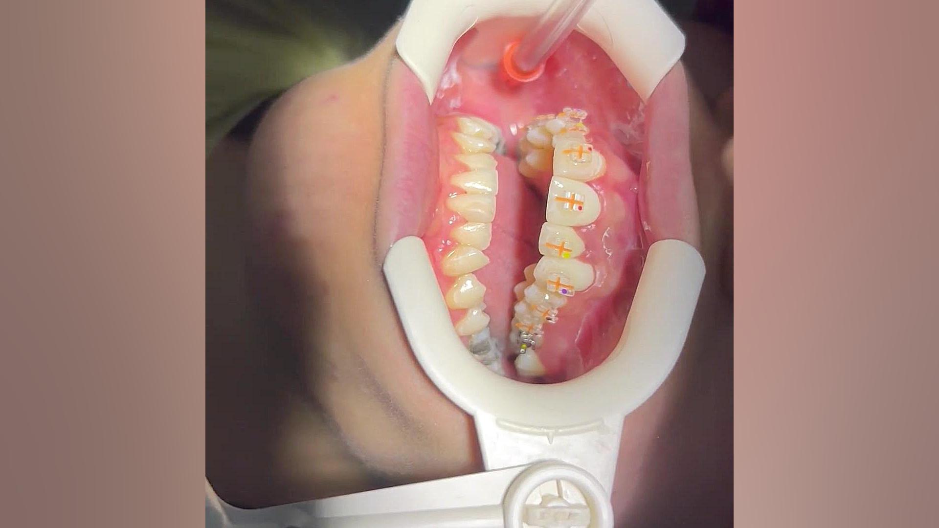 ارتودنسی سرامیکی دكتر مهدي فهيمي هنزائي