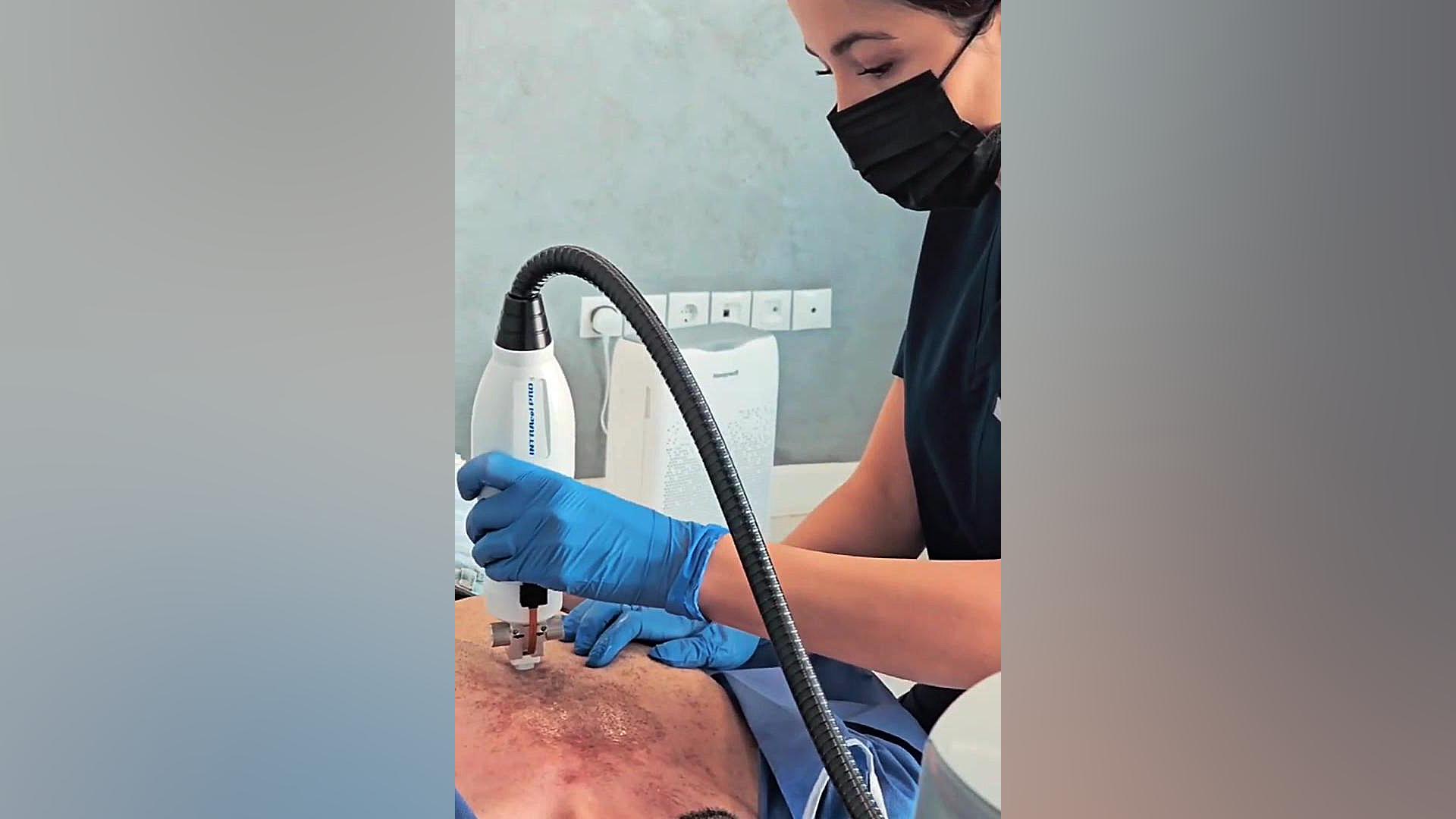 دستگاه rf fractional دکتر عاطفه فرامرزی | Dr Atefeh Faramarzi