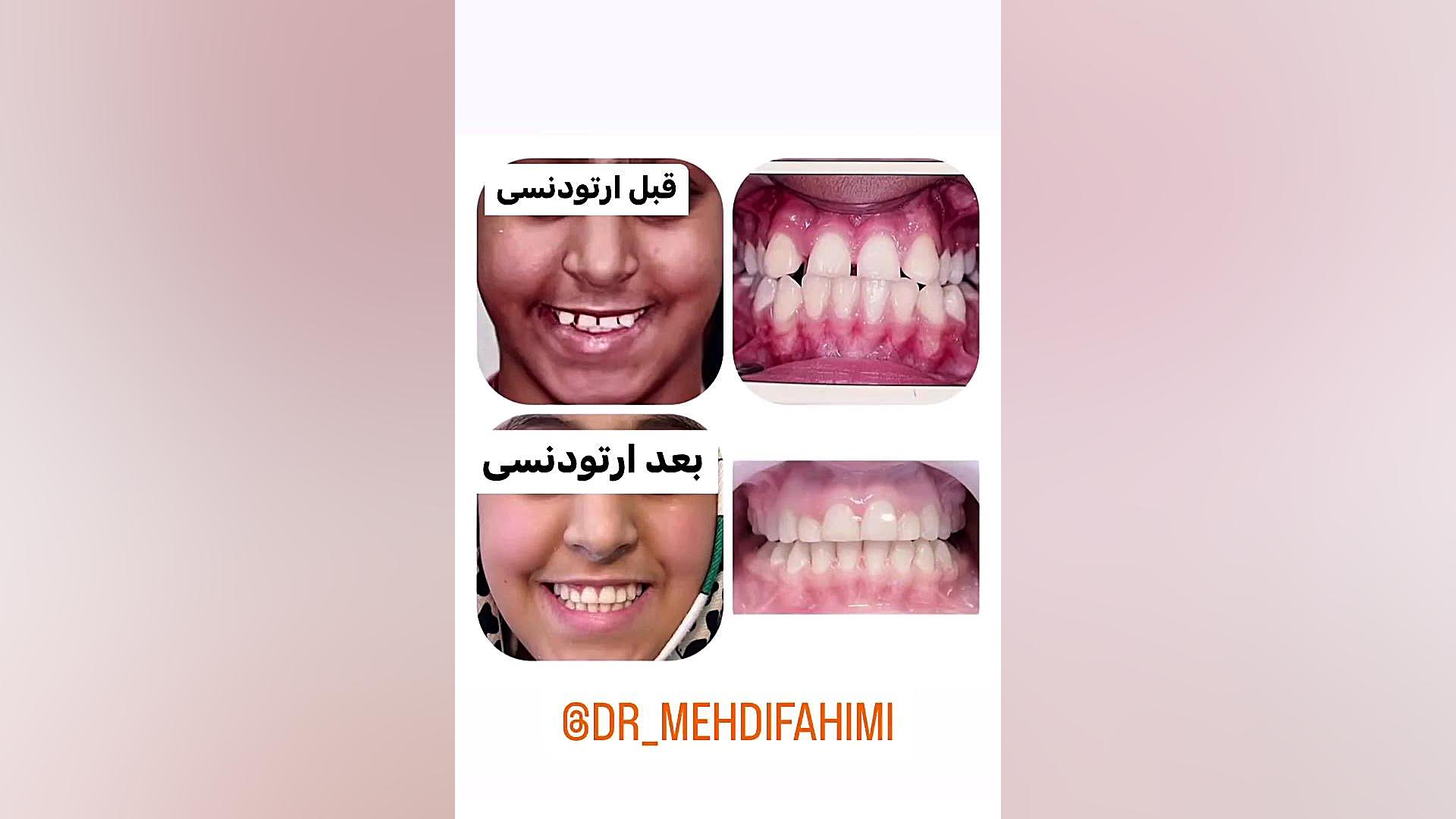ارتدنسی دكتر مهدي فهيمي هنزائي