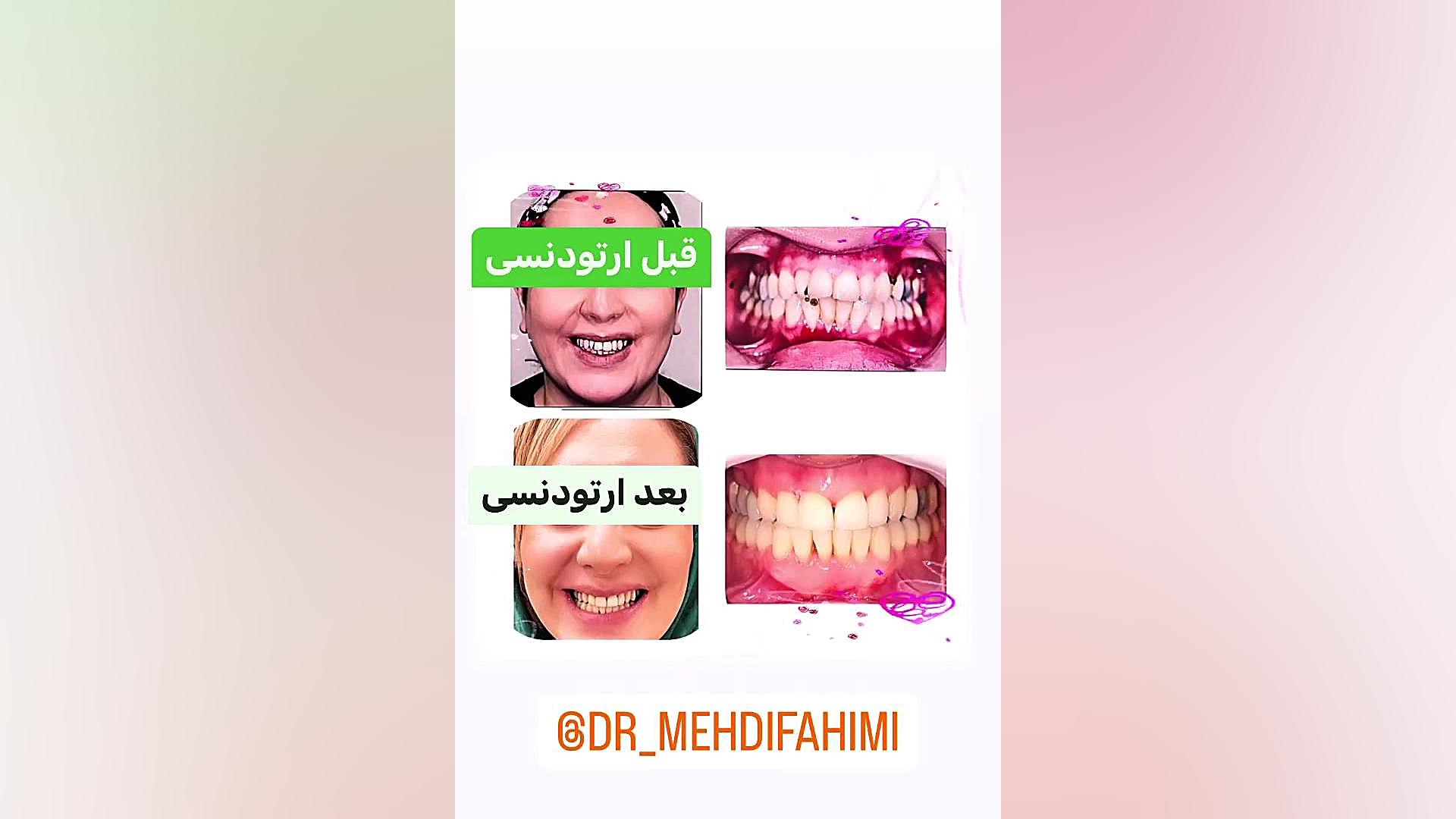 ارتدنسی دكتر مهدي فهيمي هنزائي