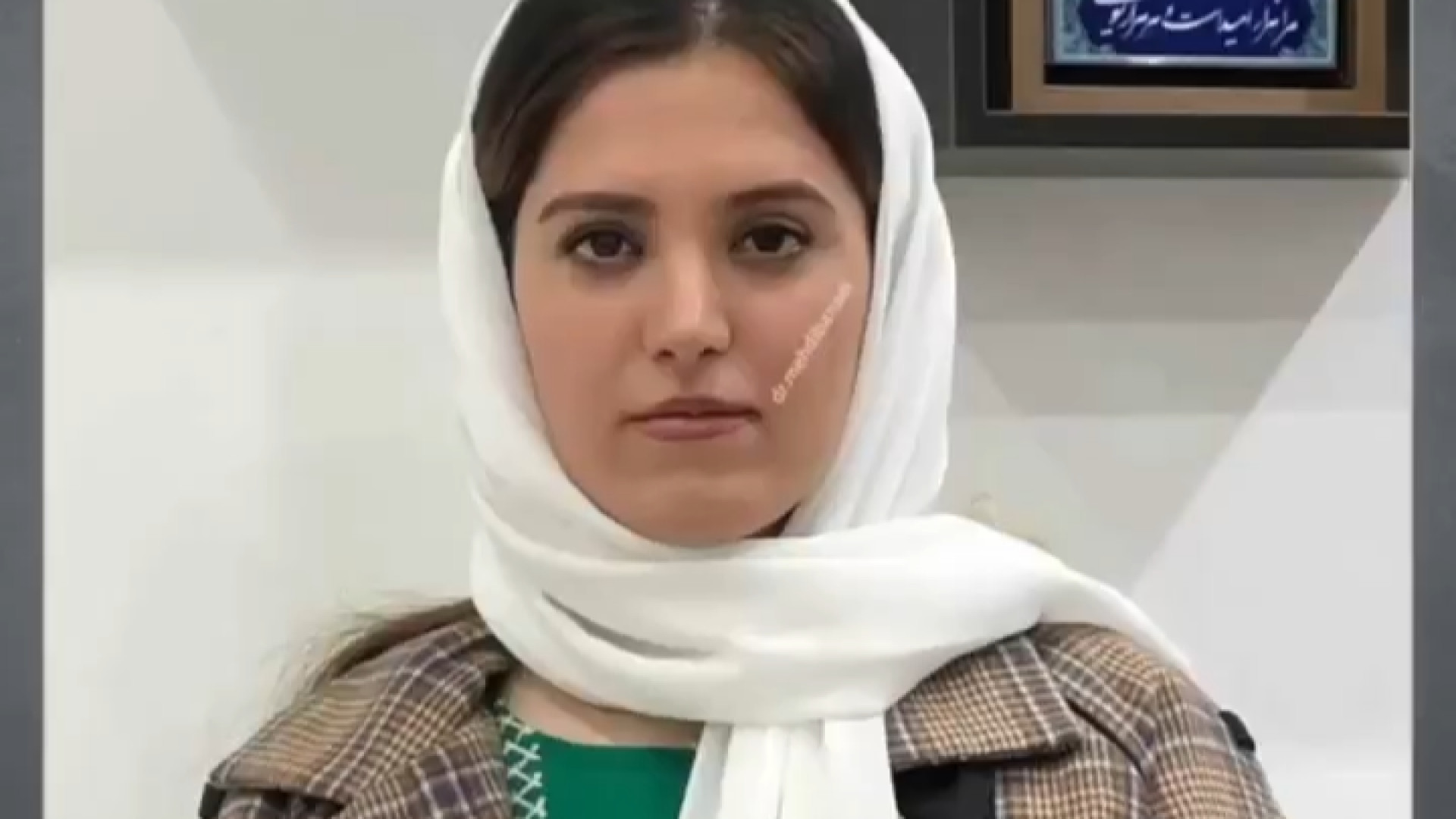 مشاهده نتیجه نهایی رینوپلاستی در ارومیه