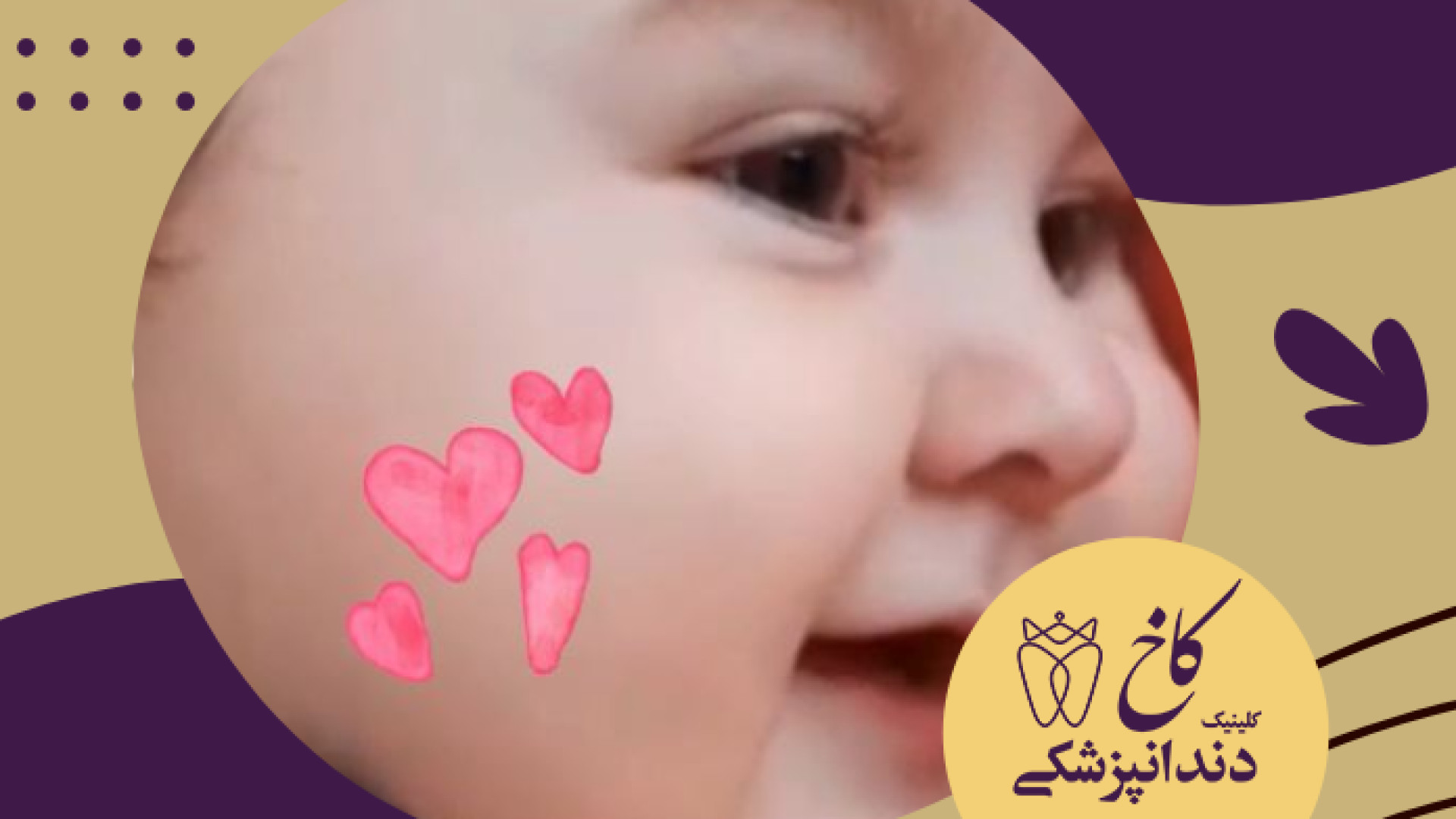 کی هوس نی نی کرد؟ کلینیک دندانپزشکی کاخ