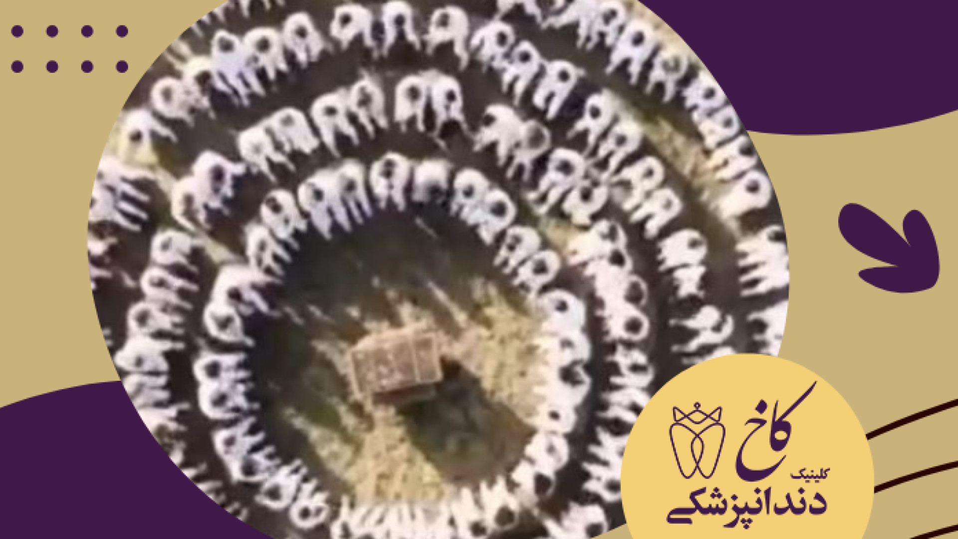 هماهنگی عصب و عضله در بازی های قدیمی ایرانی کلینیک دندانپزشکی کاخ