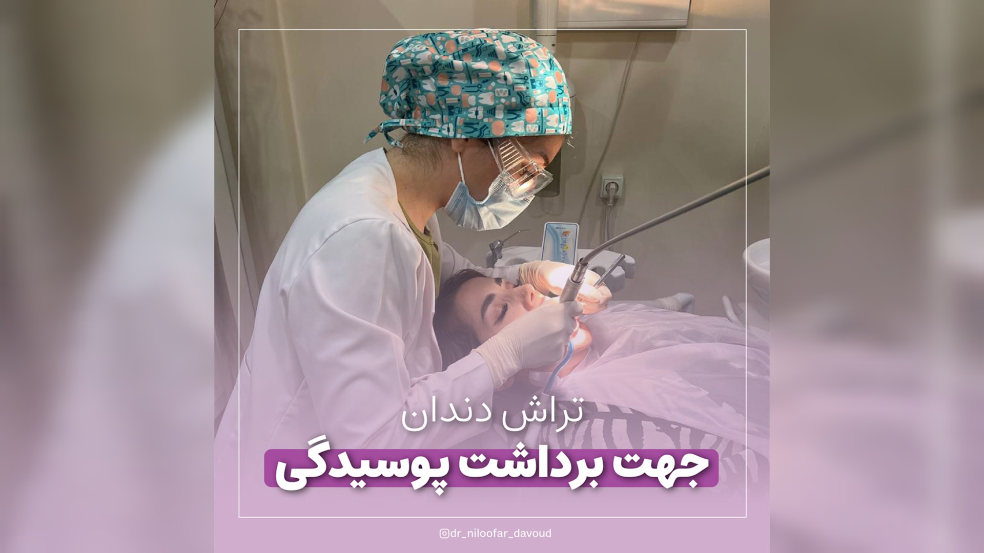 انجام جرمگیری برای دندان های بسیار حساس ریتوکسیمب-هایبرید