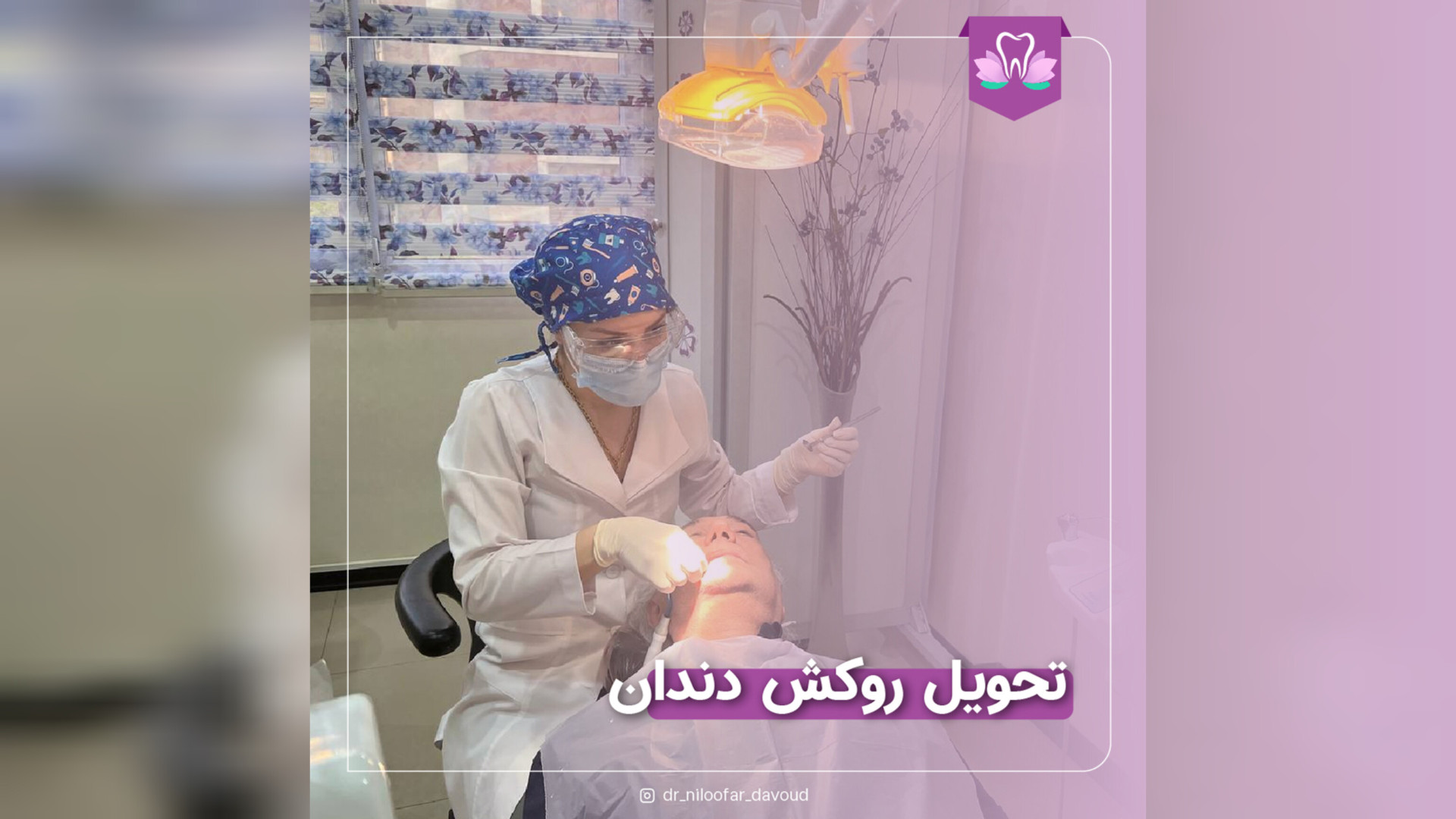 اصلاح ارتفاع روکش دندان و ضرورت آن تری‌متازیدین