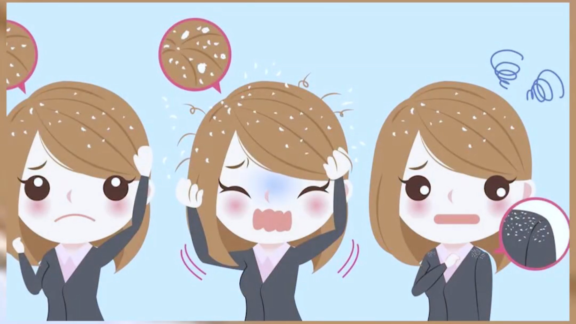 شوره سر و درماتیت سبورئیک لیلا بلوکات