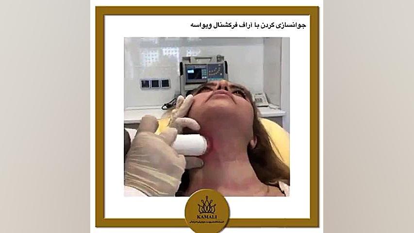 جوانسازی گردن با آر اف فرکشنال بیماری پورفیری اریتروپوئتیک