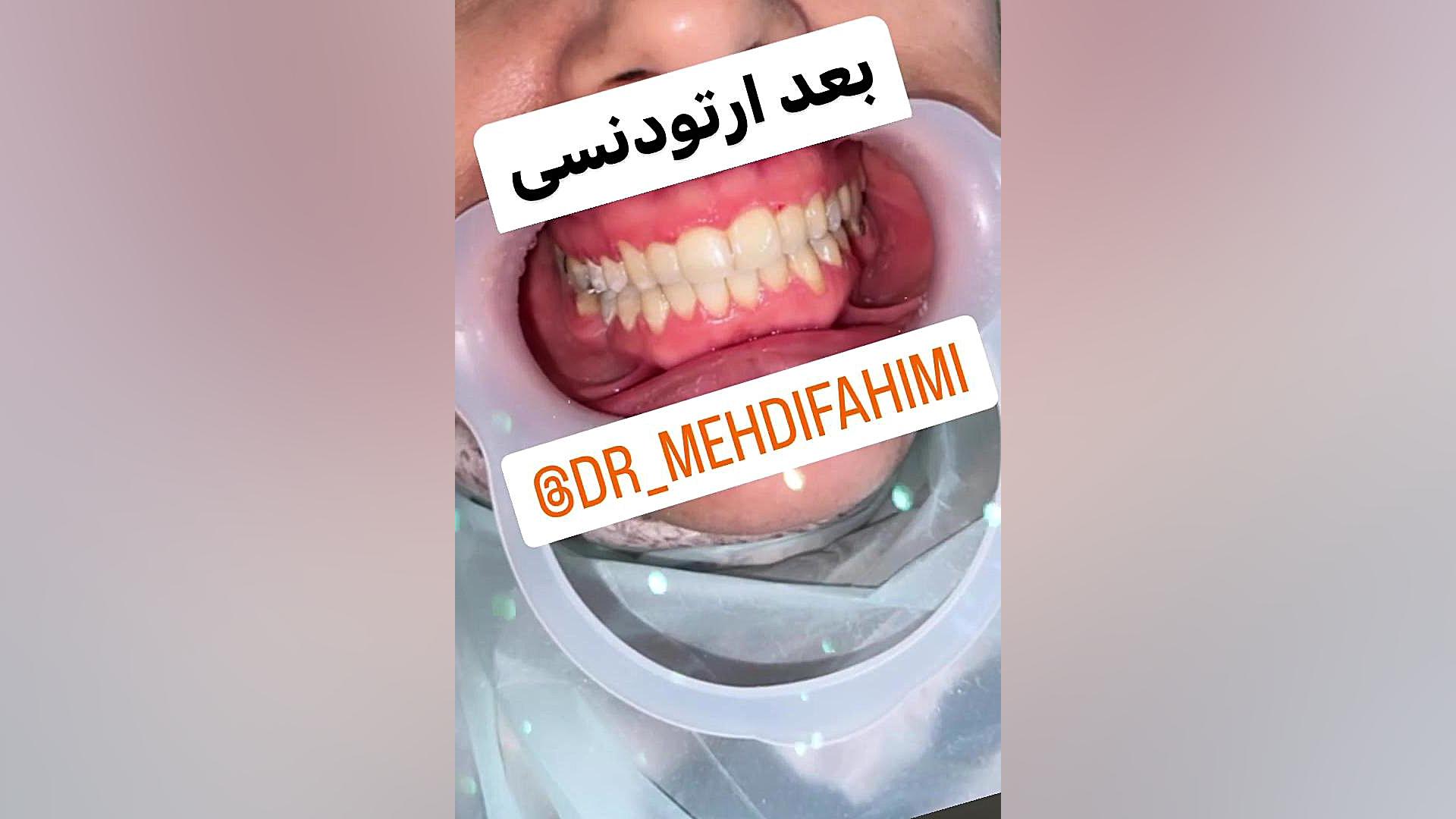 ارتودنسی دكتر مهدي فهيمي هنزائي