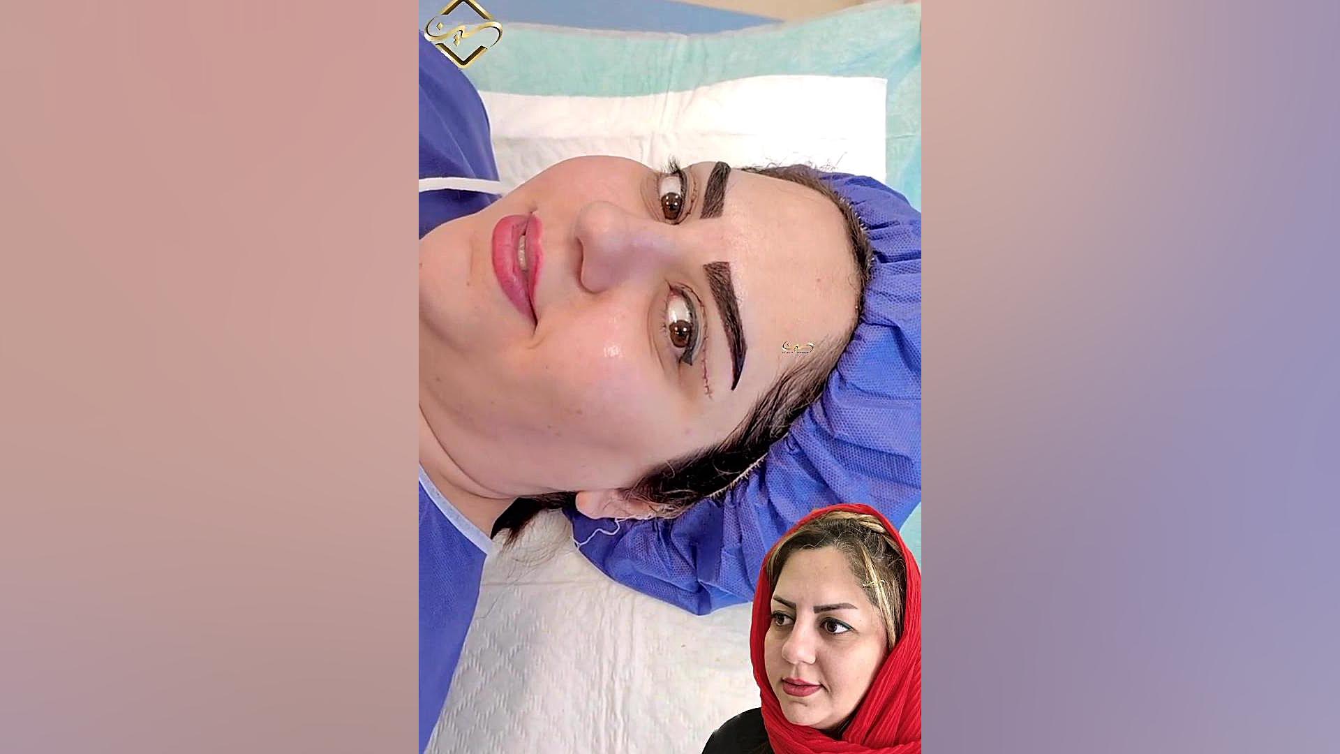 بهترین کلینیک کاشت ایربسارتان