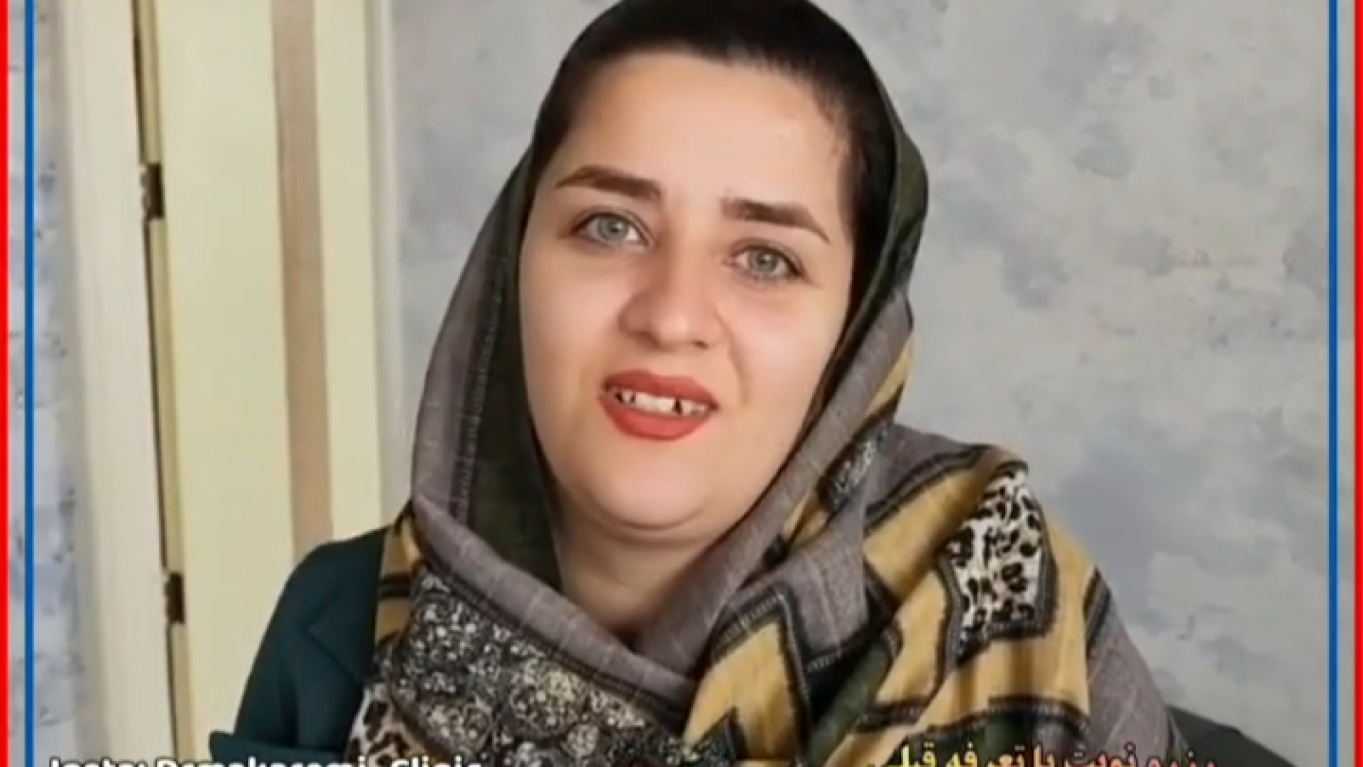 این عمل به صورت بدون ناشتا و بیهوشی به صورت سرپایی میباشد عمل زیبایی