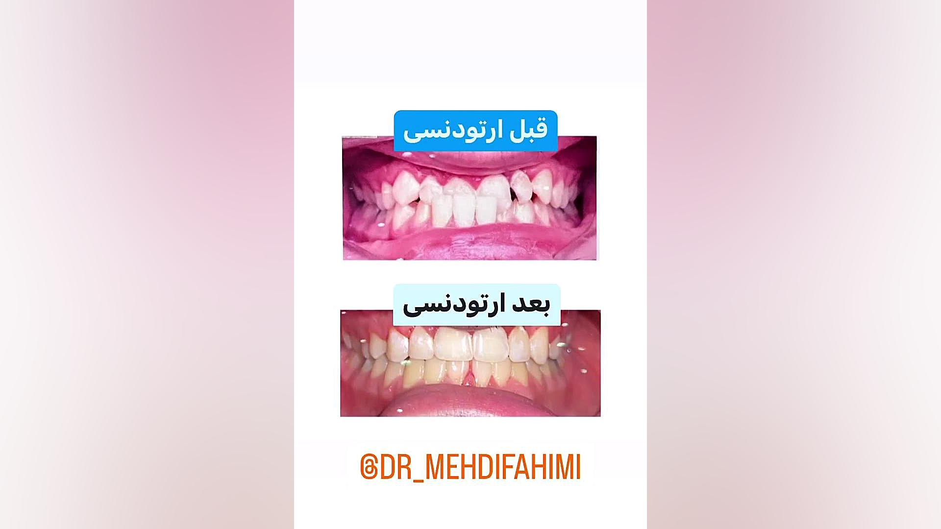 ارتودنسی دکتر فهیمی دكتر مهدي فهيمي هنزائي