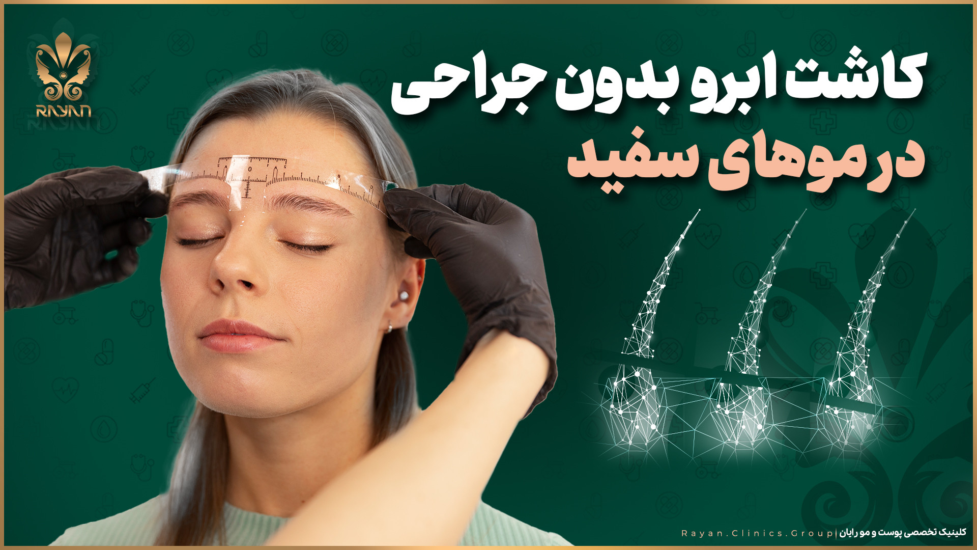 کاشت ابرو در موهای سفید بدون جراحی Synaptic Vesicle Tracking