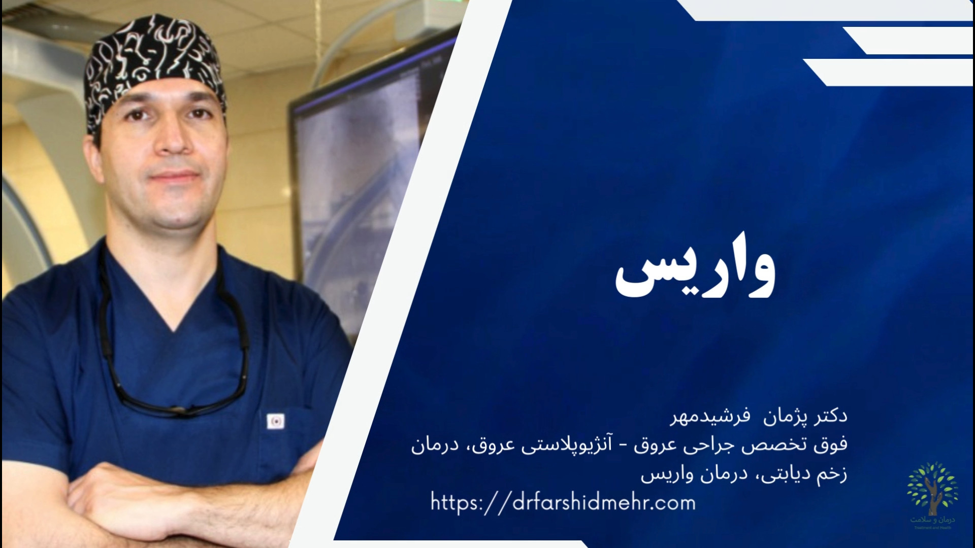 واریس شدید و رگ های طنابی نارسایی ( برگشت خون ) درچه لانه کبوتری دندانپزشکی کودکان