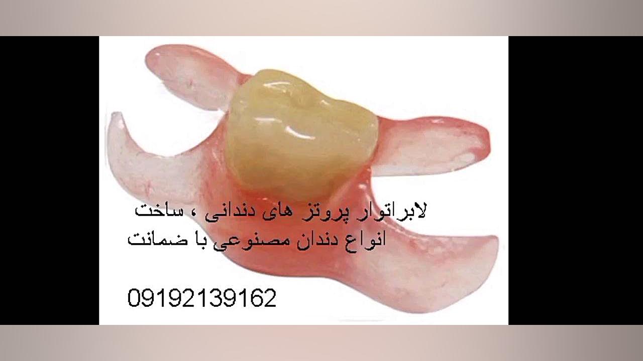 لابراتوار دندانسازی دندان مصنوعی ژله ای جایگزین ایمپلنت لمینیت کامپوزیت آزمون NanoString