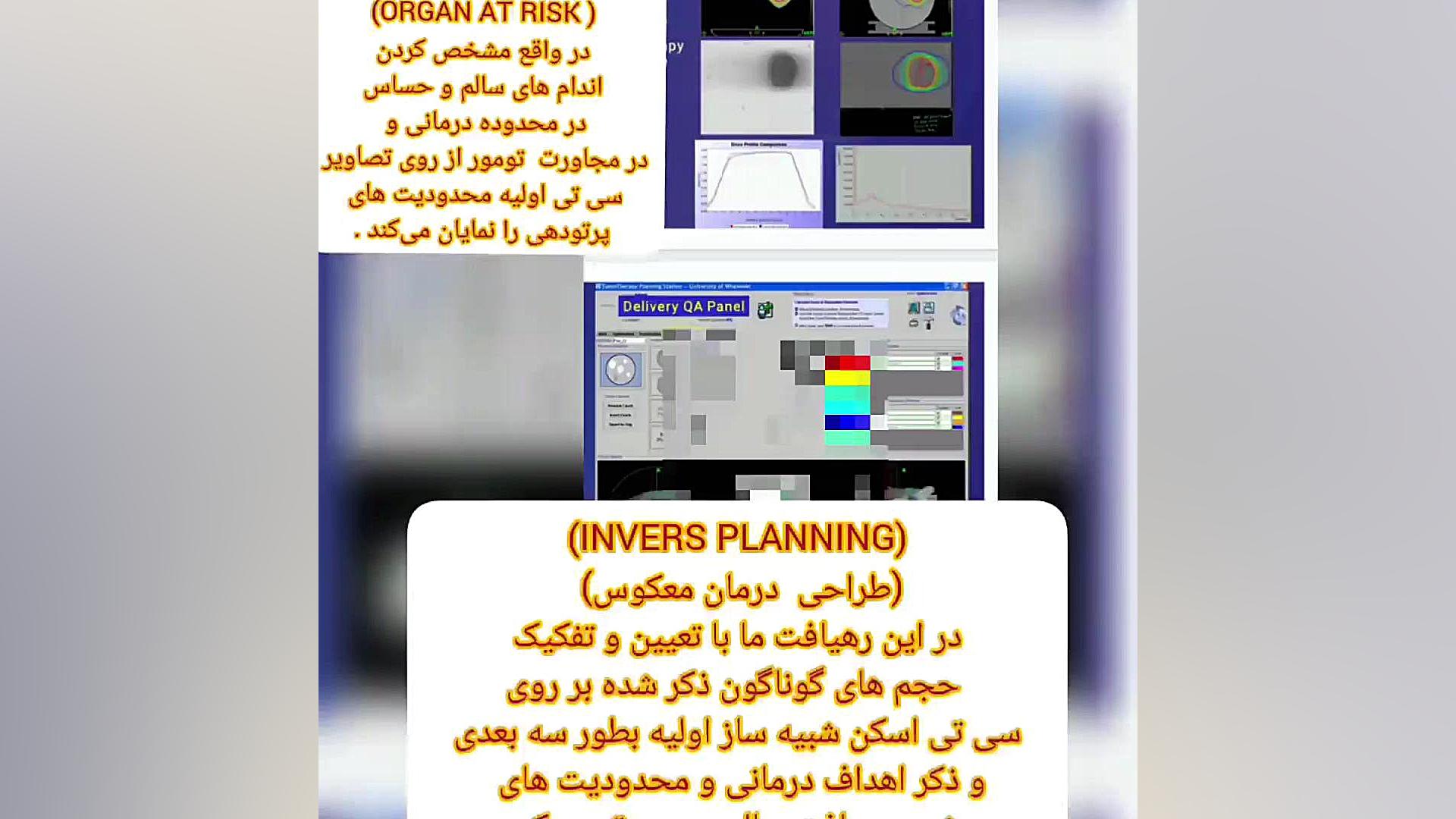 از پرتودرمانی نوین چه میدانید؟ مجله آنکولوژی ( دکتر رضا )خدابخشی