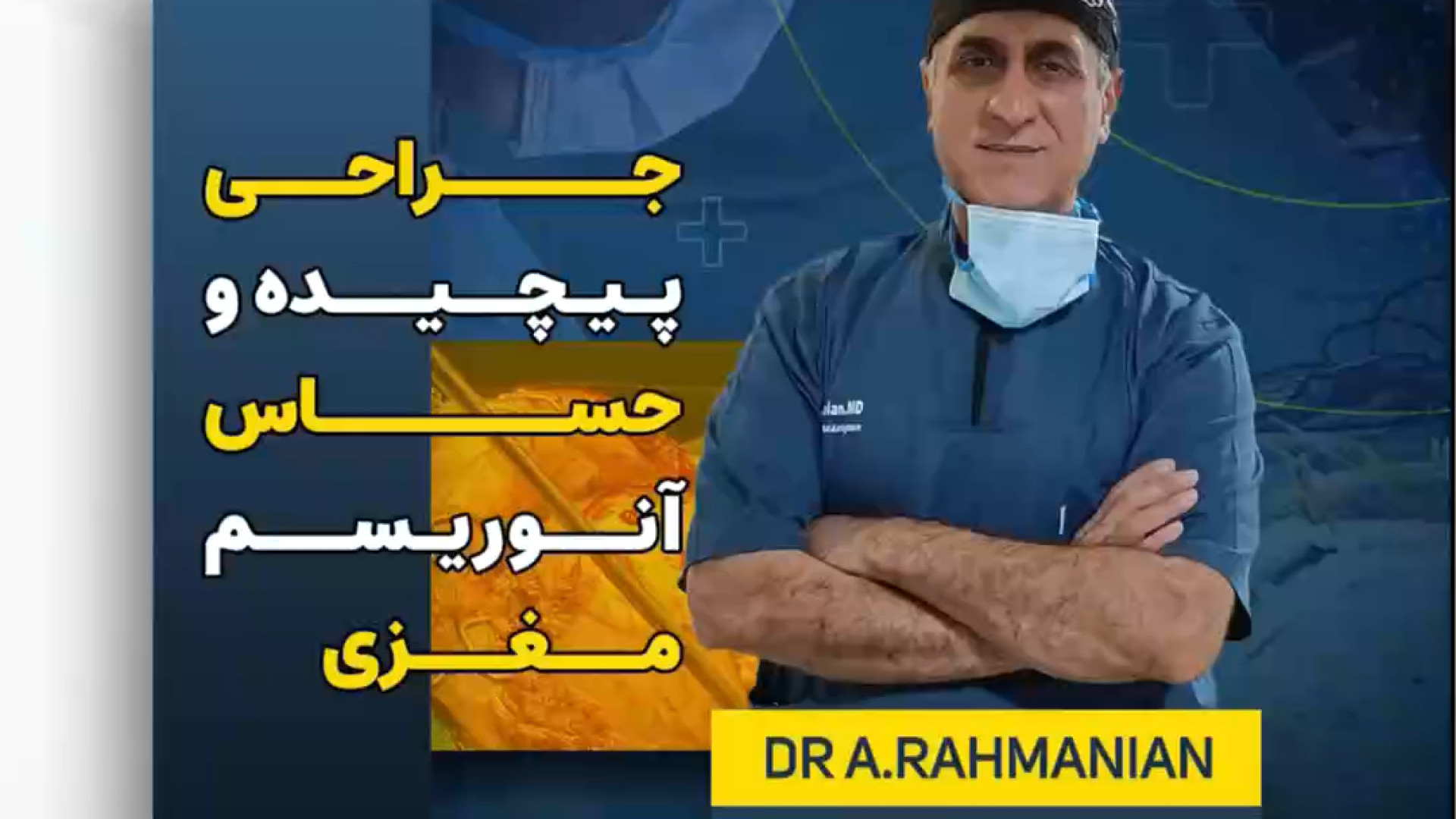 جراحی پیچیده و حساس آنوریسم مغزی آقای 43 ساله رفع چین و چروک