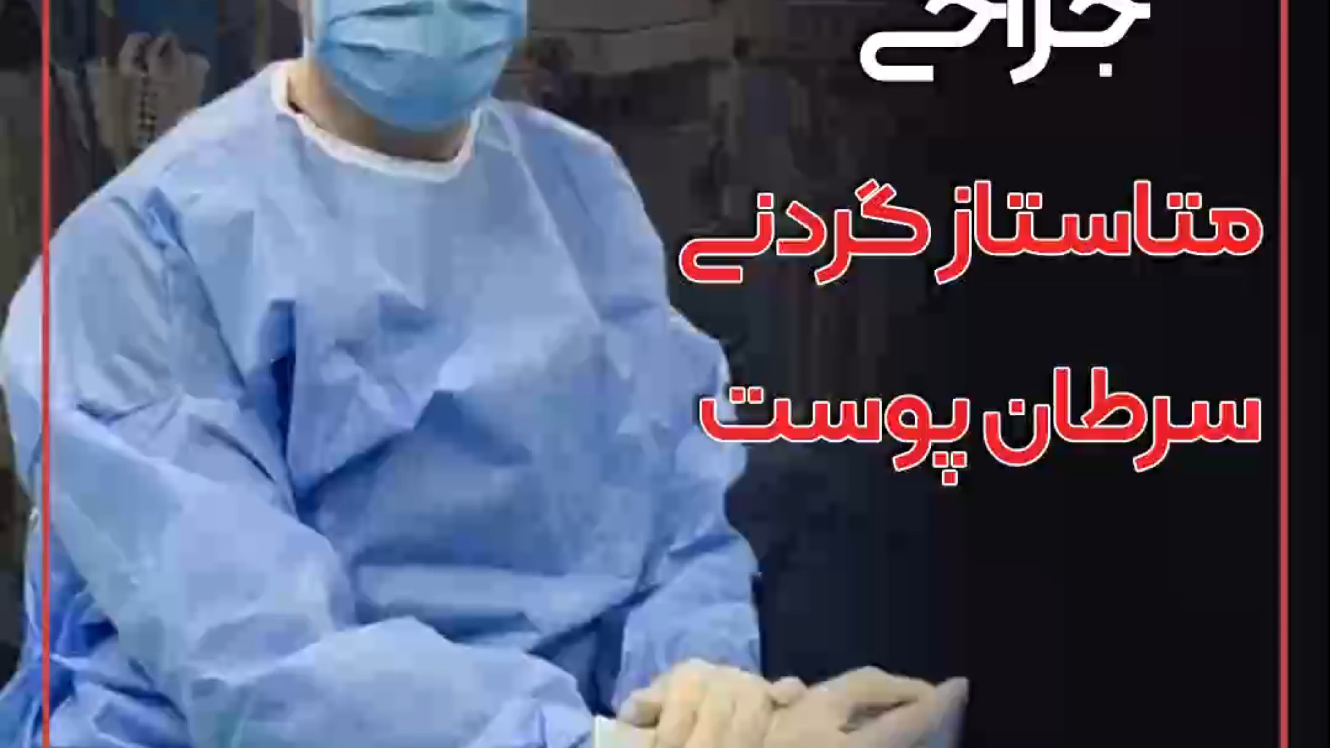 جراحی متاستاز گردنی سرطان پوست کریس همسورث