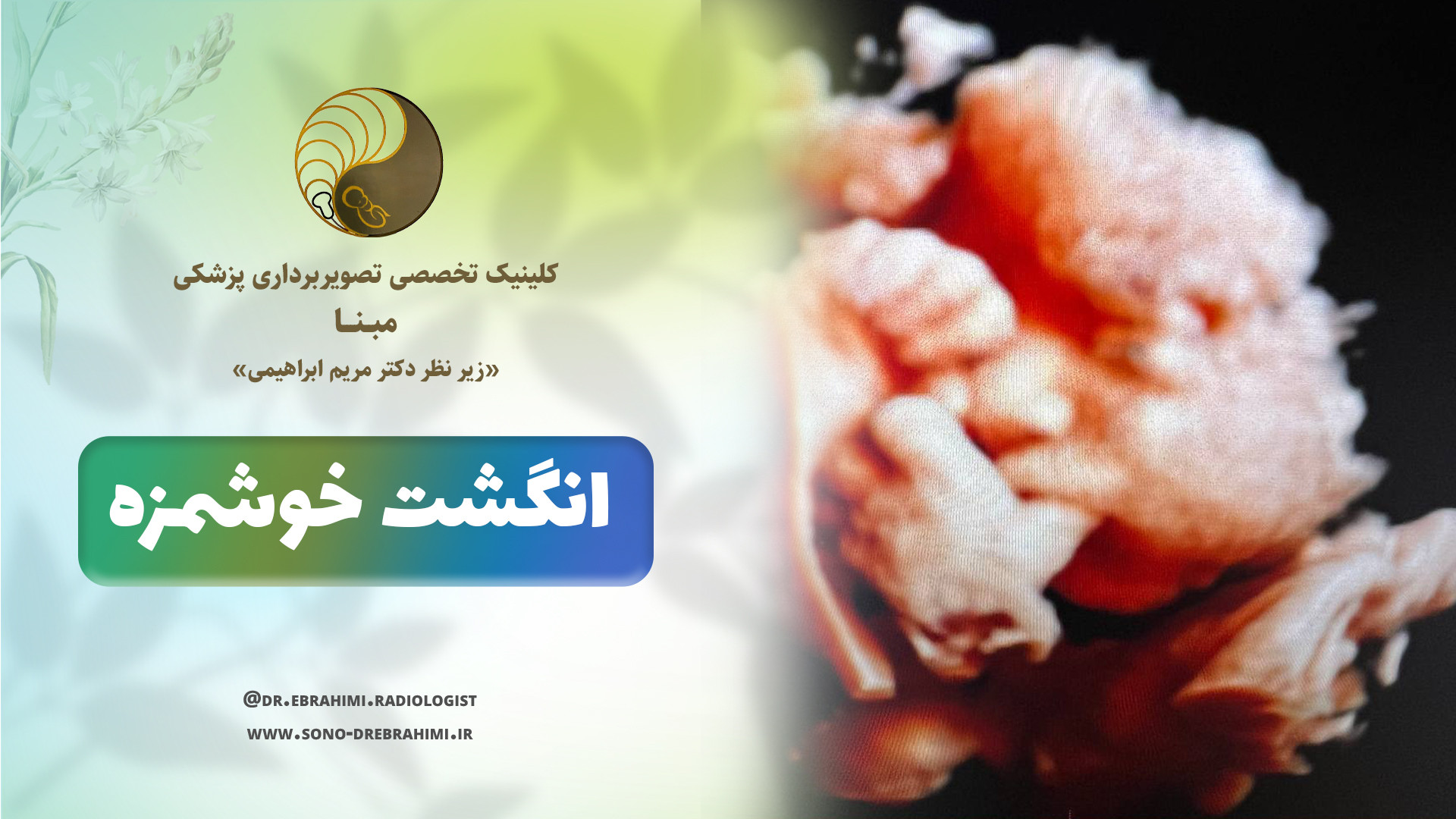انگشت خوشمزه جنین مرکز تصویربرداری دکتر مریم ابراهیمی، مبنا-تهران