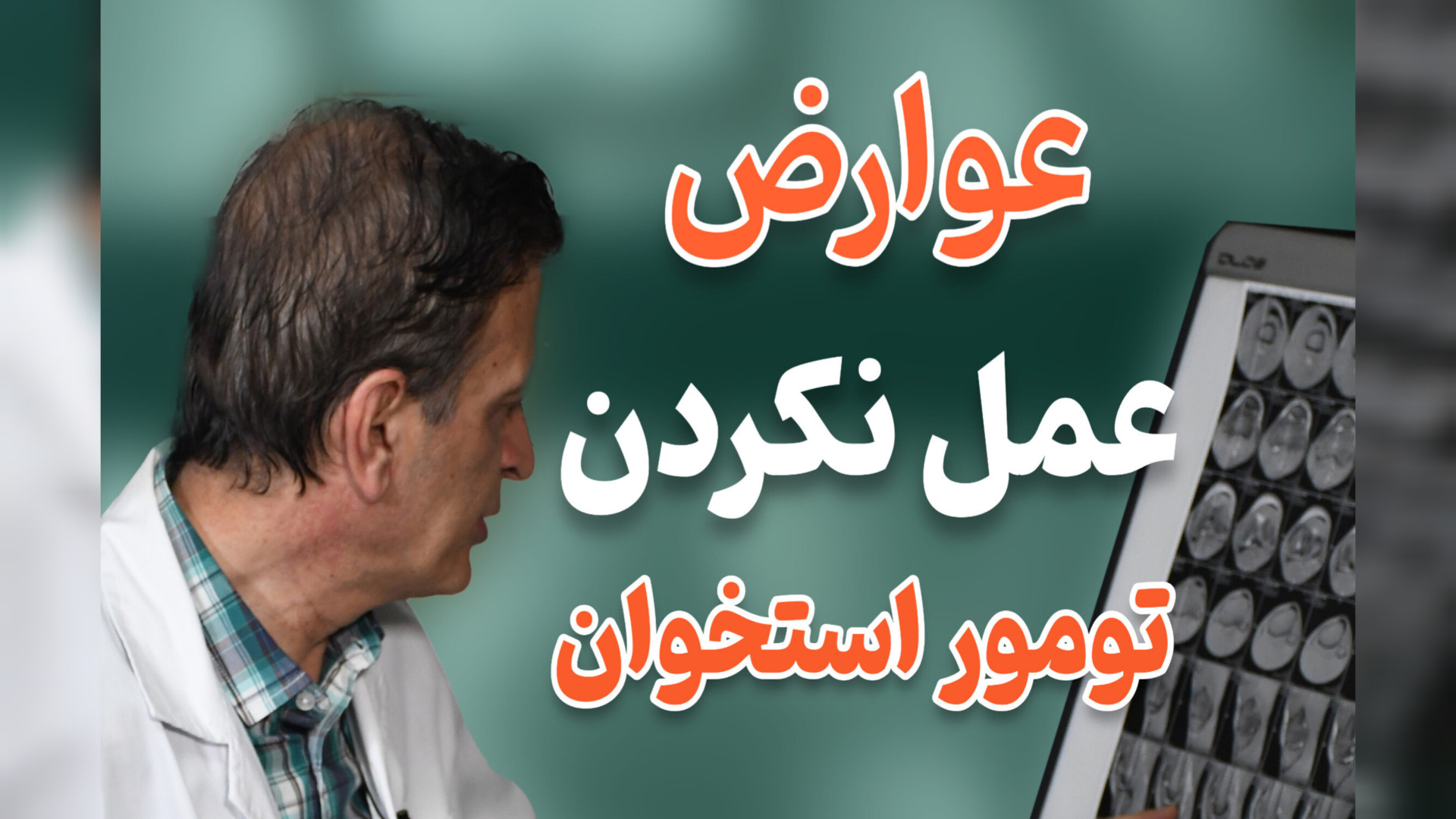 عوارض عمل نکردن تومور استخوان دکتر محمود جعفر بیگلو
