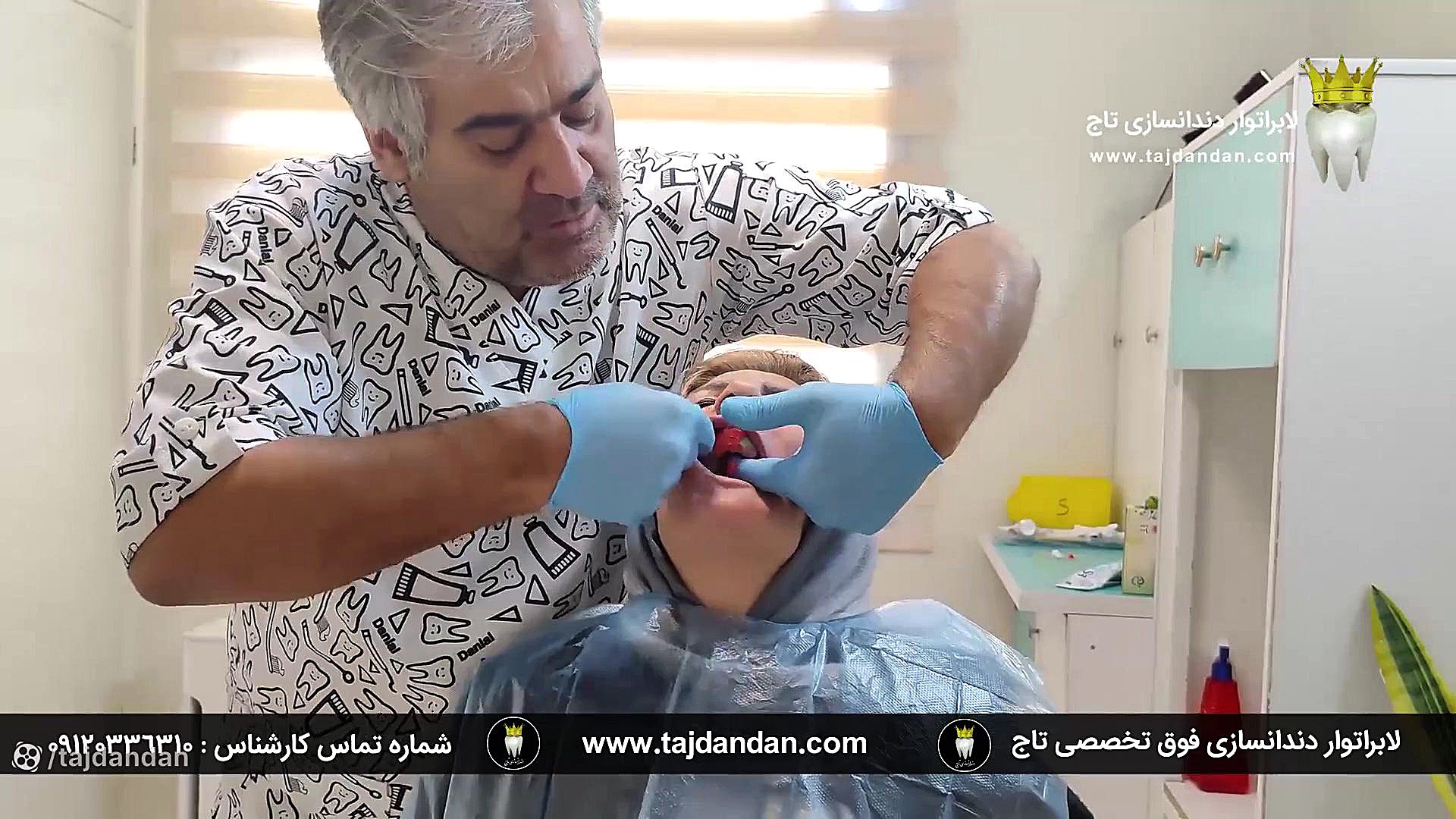 رضایت بیمار فاقد لثه از قالبگیری و ساخت پروتز دندان متحرک ایووبیس سوئیسی کاشت ریش