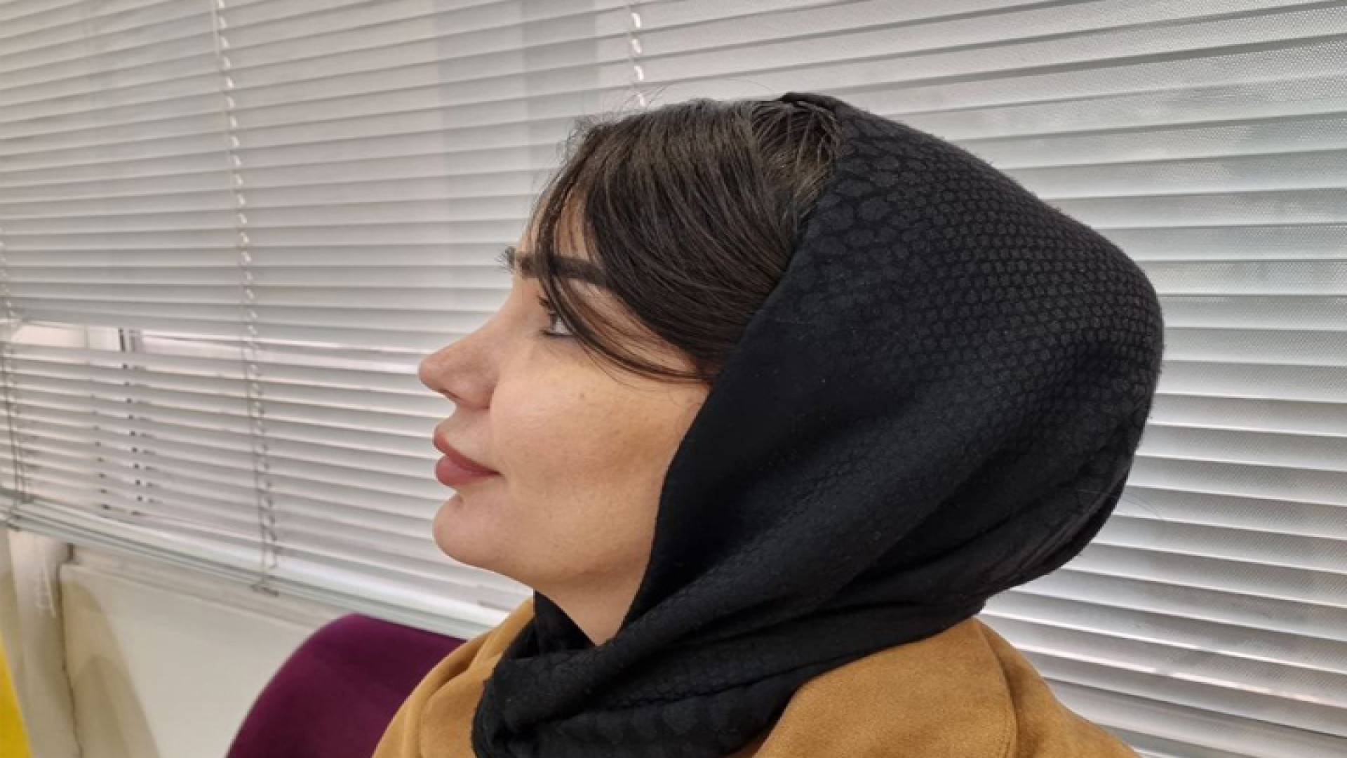 جراحی زیبایی بینی - دکتر مهرداد مقیمی آذر 1402 دکتر مهرداد مقیمی