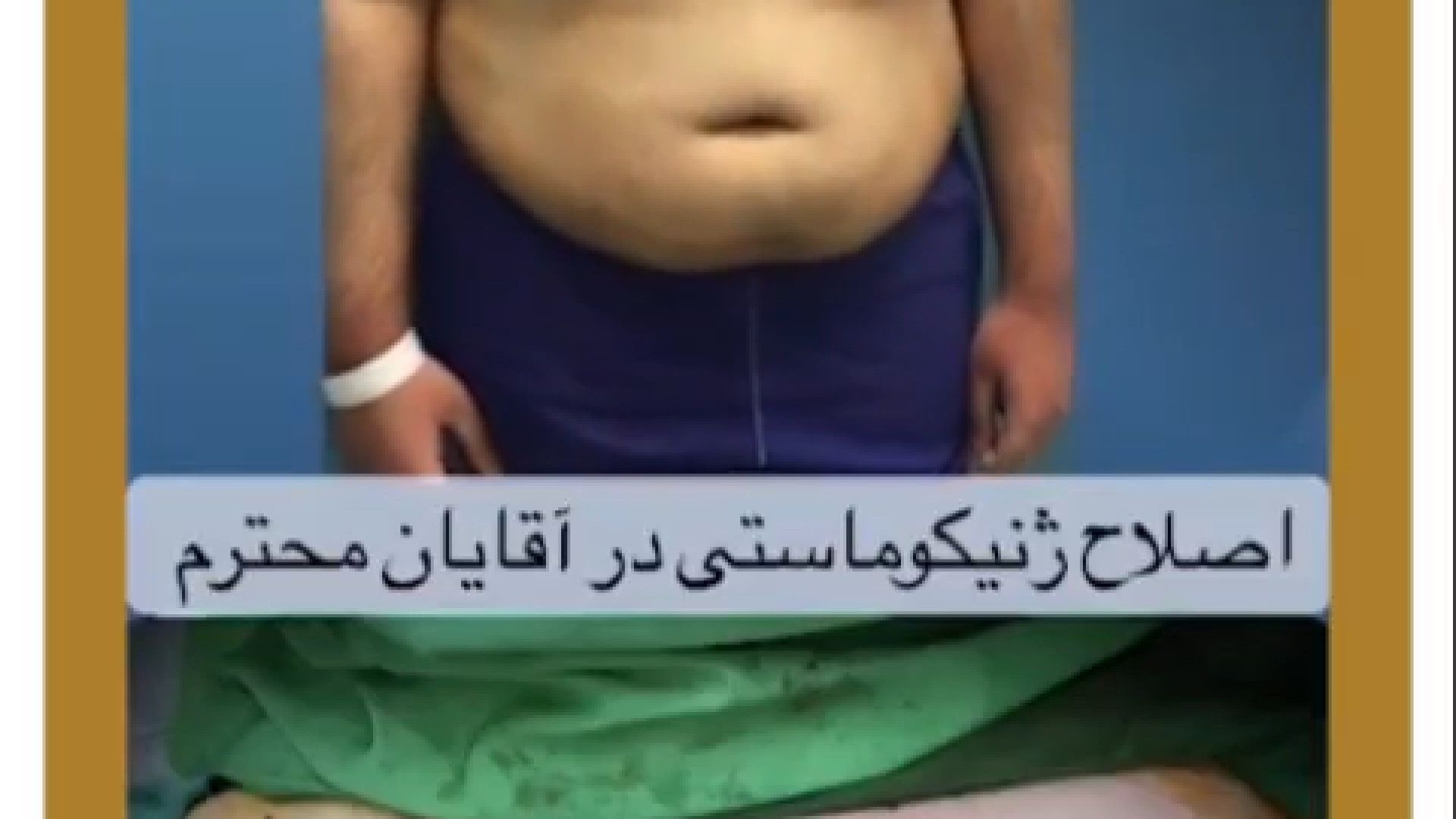 فیلم ژنیکوماستی آقایان دکتر بیژن فریدنیا