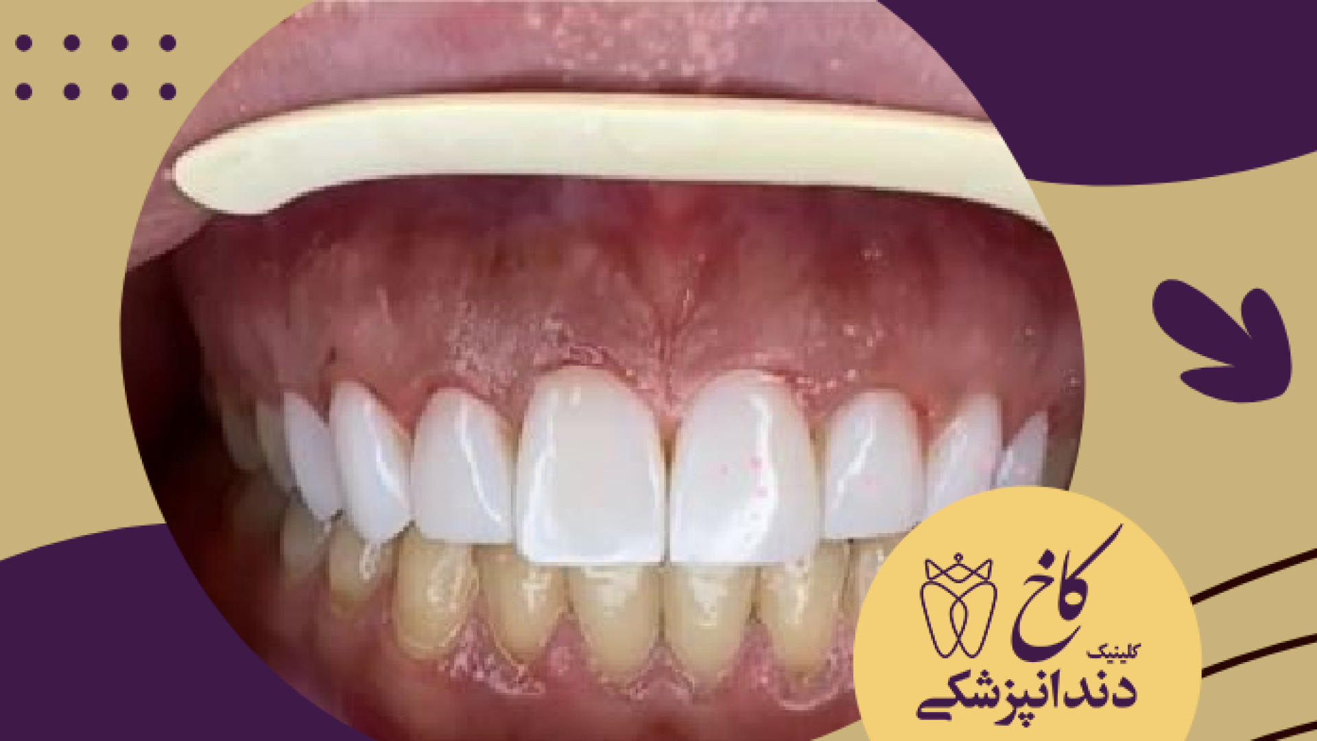 چطور شده؟ کلینیک دندانپزشکی کاخ