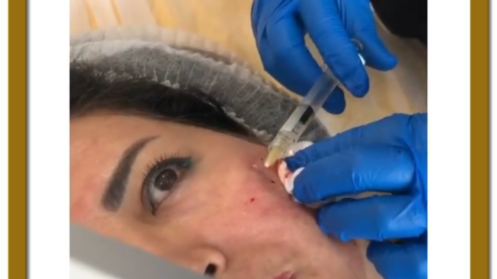 همه چیز درباره درمان لک صورت پوسیدگی دندان