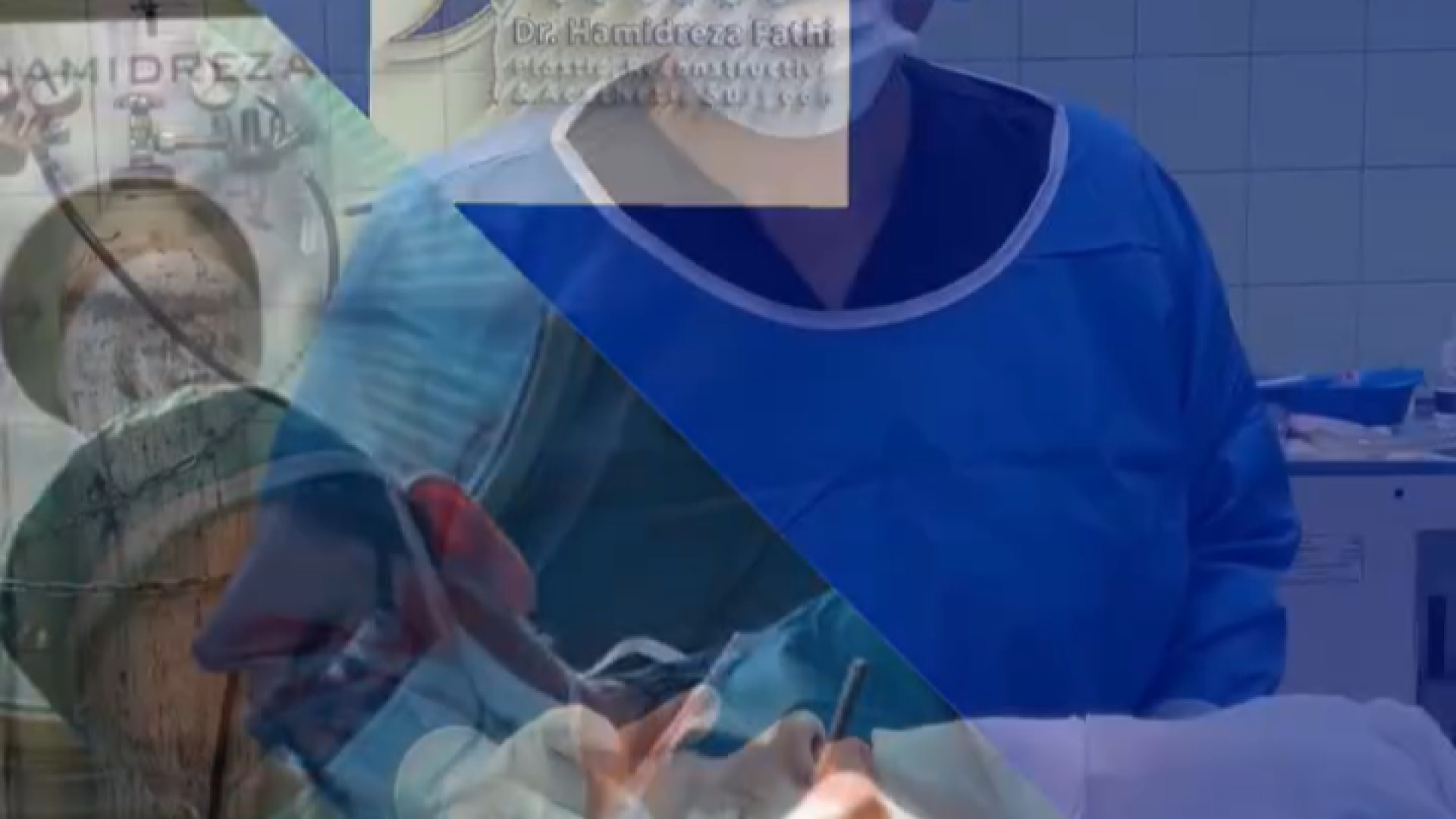 فیلم عمل بلفاروپلاستی و لیفت پیشانی دکتر حمید رضا فتحی فوق تخصص جراحی پلاستیک