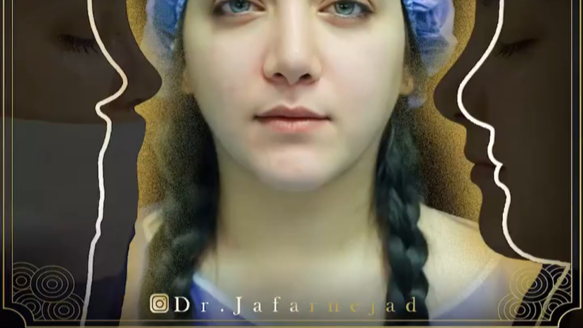 عمل بینی ترمیمی نیمه فانتزی دکتر بابک جعفرنژاد